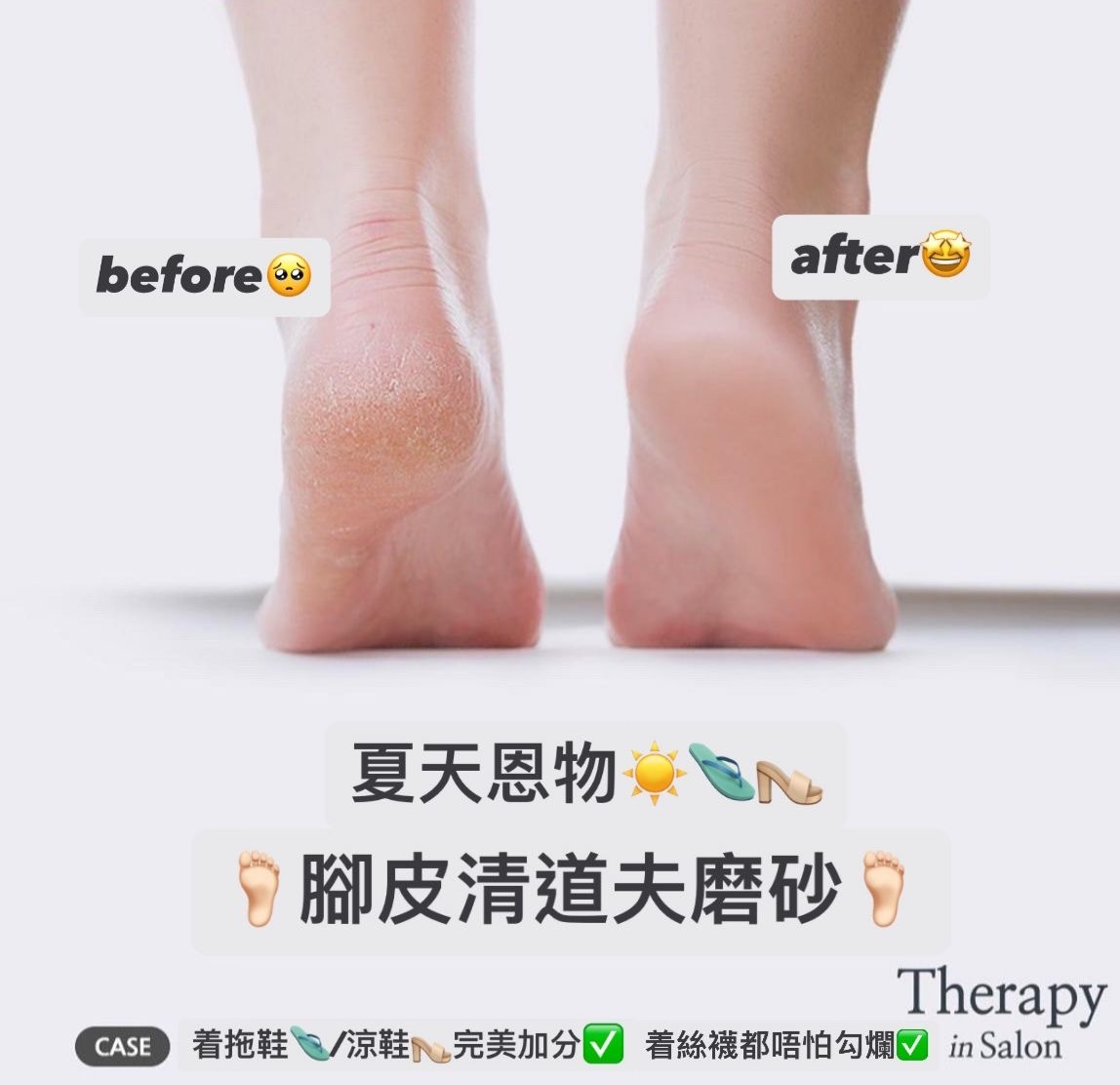 *限時半價 腳皮清道夫磨砂
