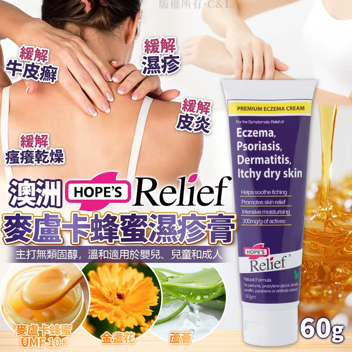 S21899 澳洲 Hope's Relief 濕疹膏60g