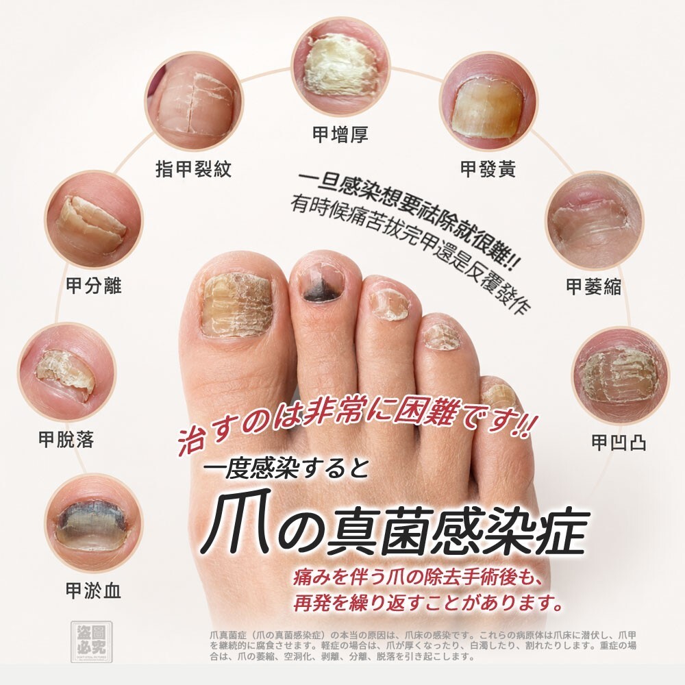 WSBB11865  日式 灰甲保健貼20貼（8月上旬）