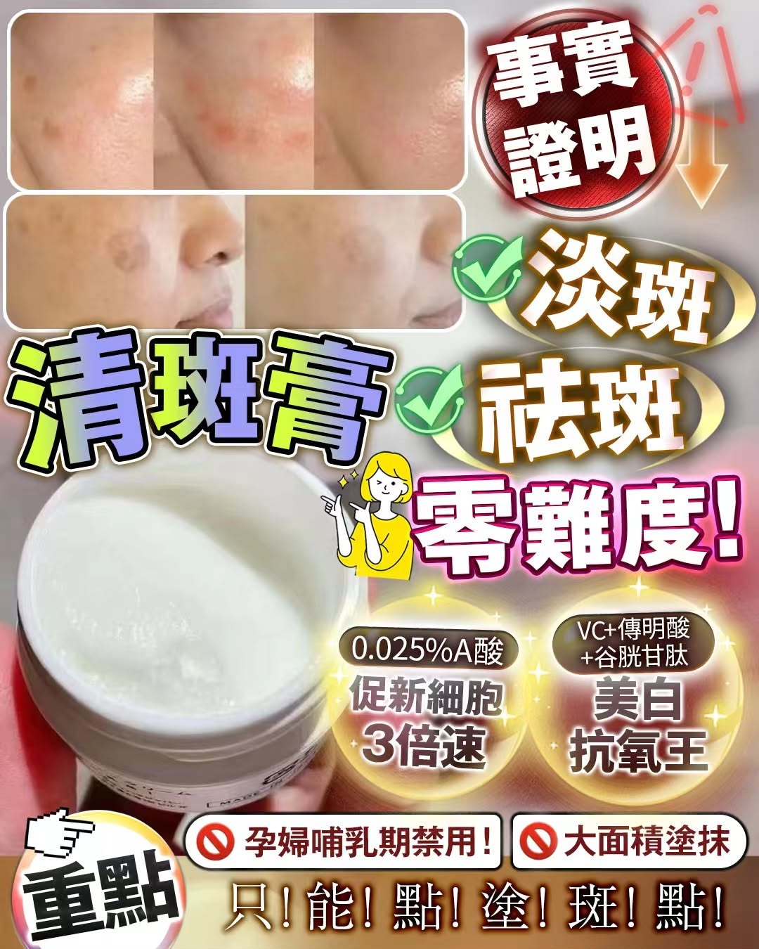 （重點塗抹）清斑膏 15g Z641（2-3星期寄出）