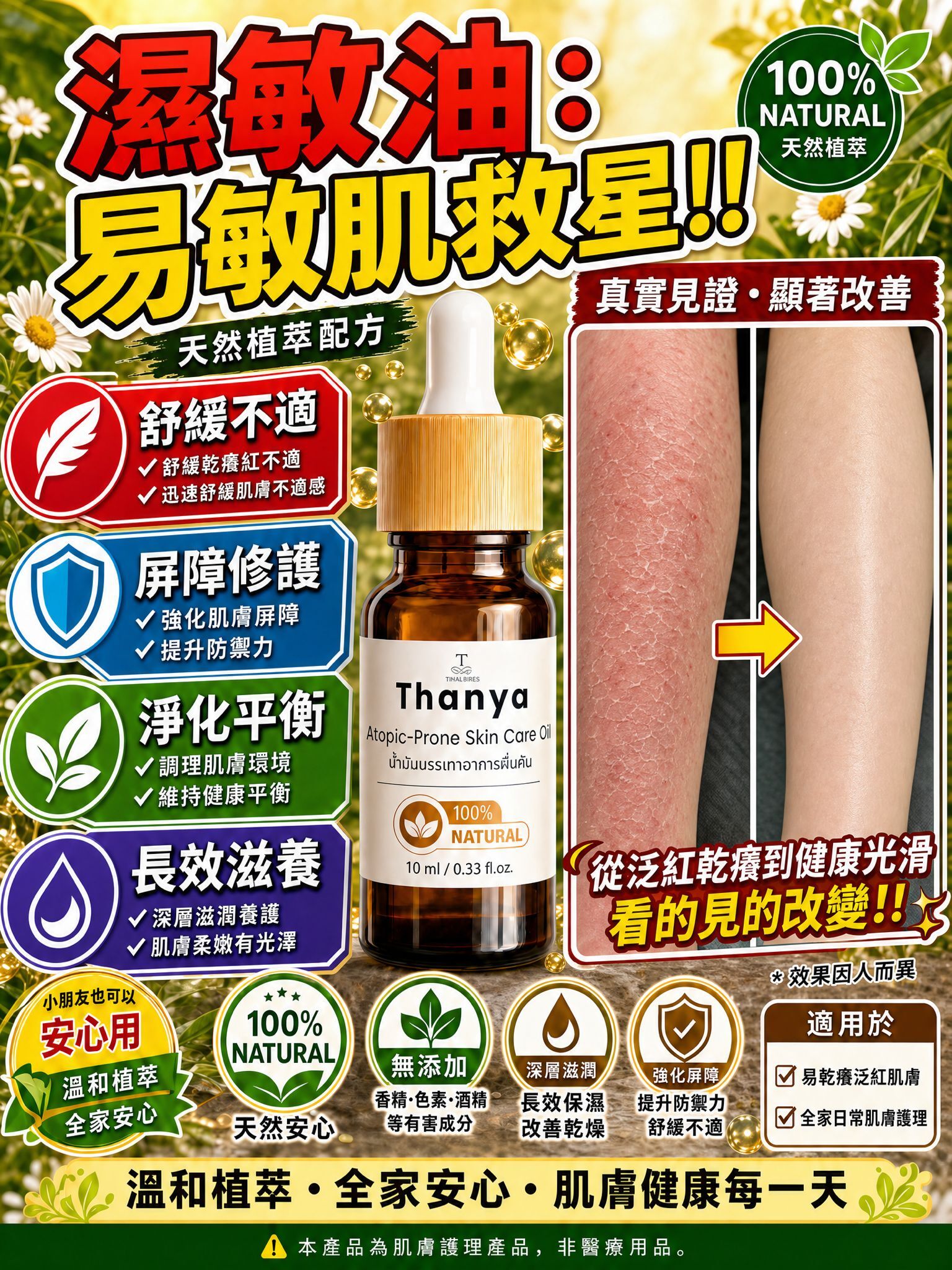 濕敏油 10ml T319 (2-3星期寄出)
