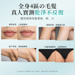 日本 JUJY 雙燈管藍寶石冰點極速連閃無痛嫩膚全身家用脫毛儀 PRO 2.0【正品】冰感無痛 × 全身脫毛 × 嫩膚護理一機完成