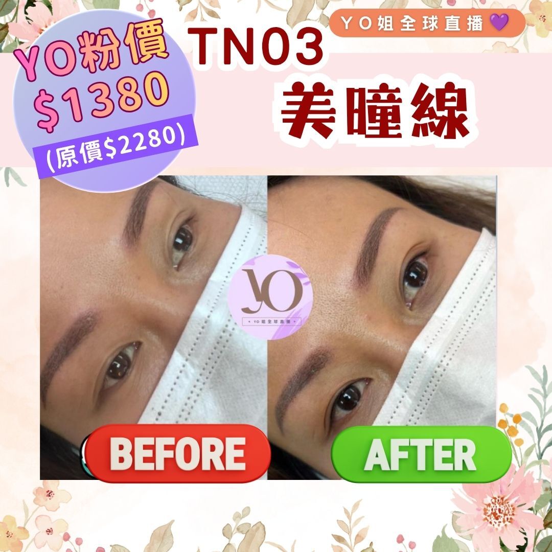 TN03 美曈線