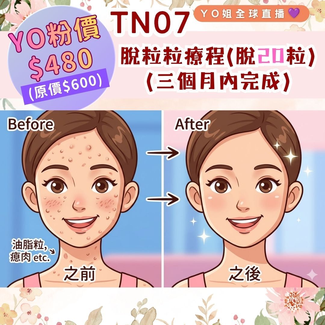 TN07 脫粒粒療程(脫20粒) (三個月內完成)