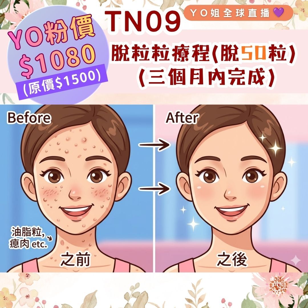 TN09 脫粒粒療程(脫50粒) (三個月內完成)