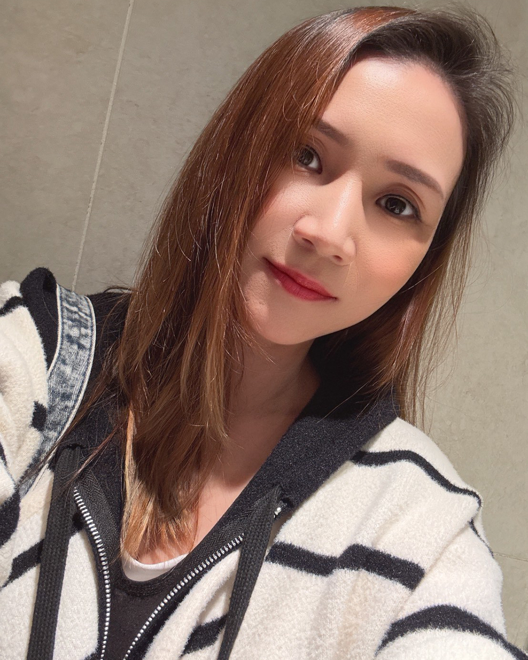 補充膠原蛋白後,狀態逐漸回穩