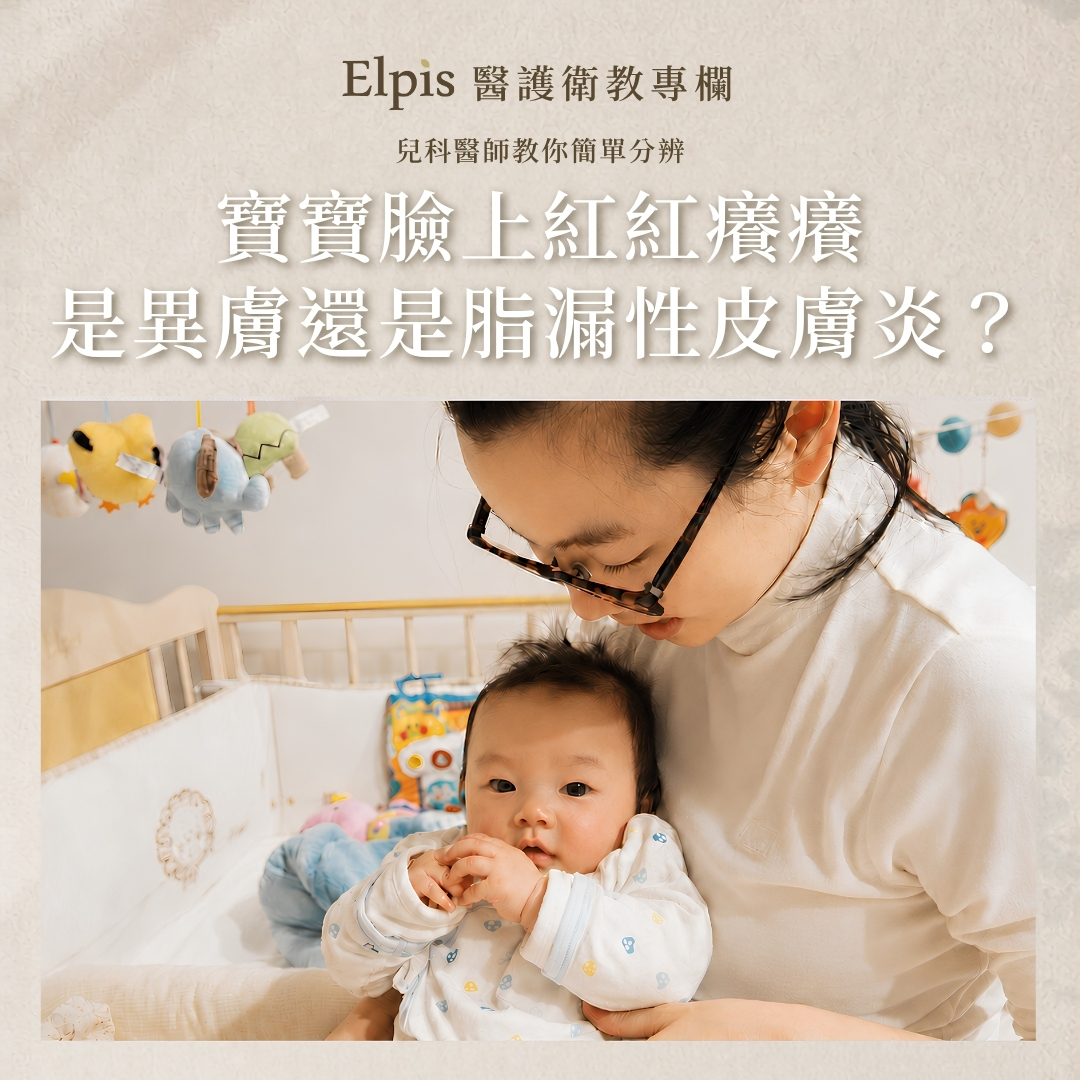 醫師教你分辨異膚還是脂漏?