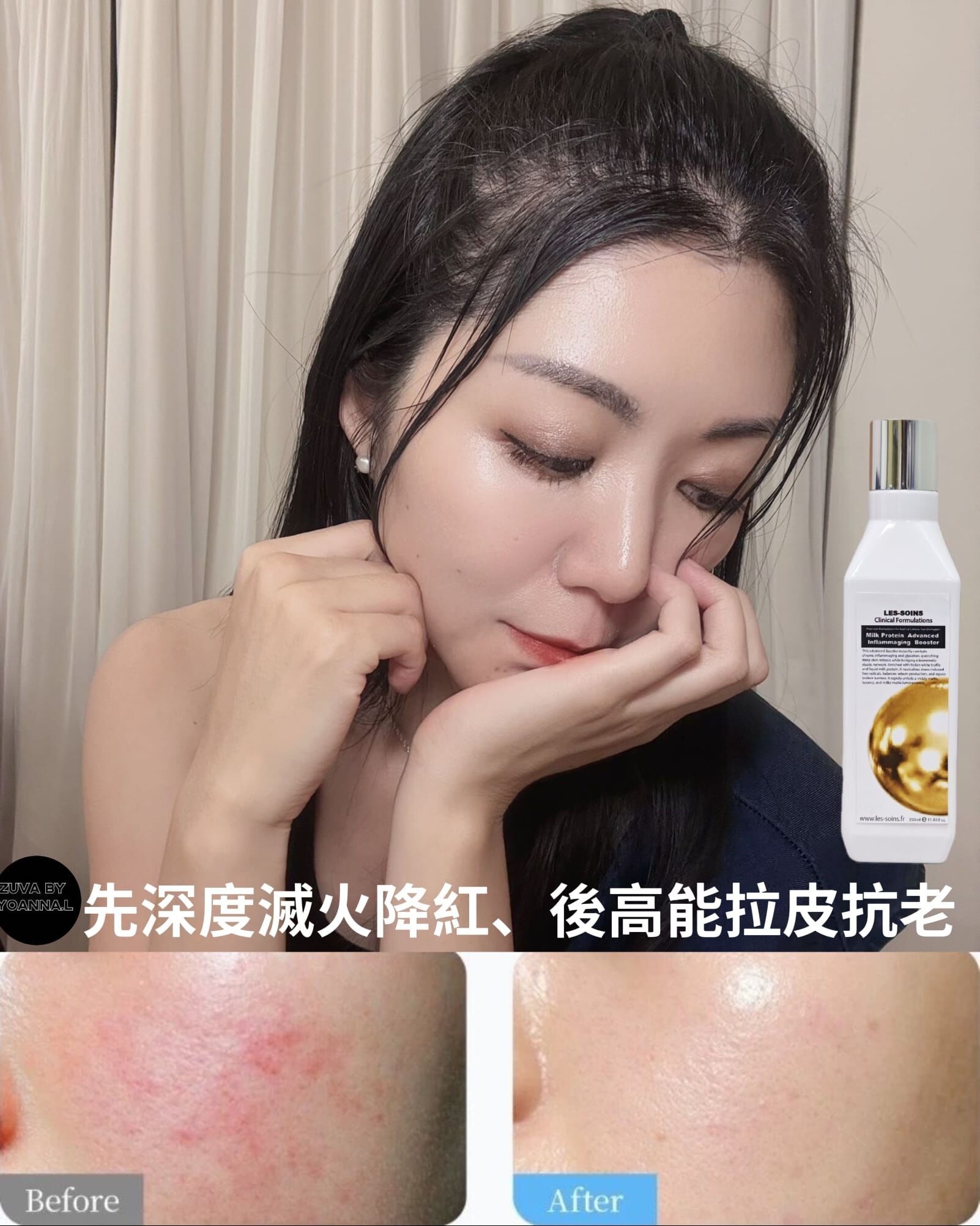 （💢 發炎抗老、濕疹、玫瑰痤瘡、術後保命水） 水感牛奶逆齡水🥛 Les Soins  牛奶蛋白神經醯胺肌底液350ml  T337👑