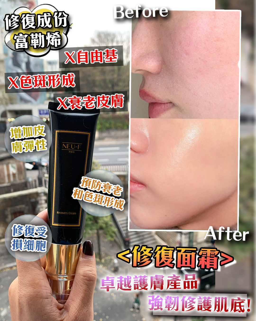 法國盛宴·會場驚喜 - Neu-F Pro Recovery Cream 修復面霜 送 Recovery Cream + Exo Glicolico 20 甘筍酸20% 收毛孔去斑去痘印精華（透明） 3枝（貨期截單後兩個月）
