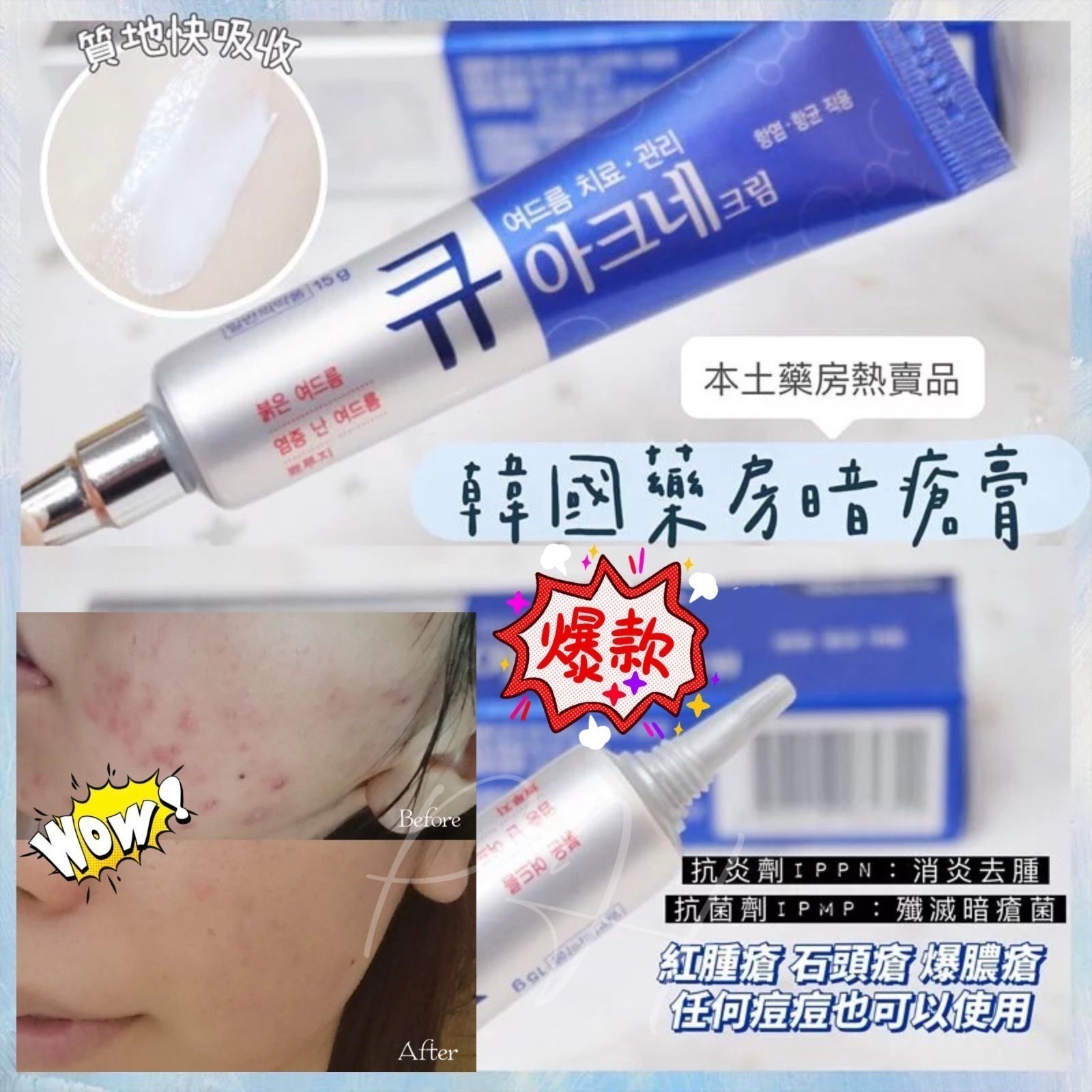 韓國本土藥房熱賣 Q Acne祛痘消炎暗瘡膏15g