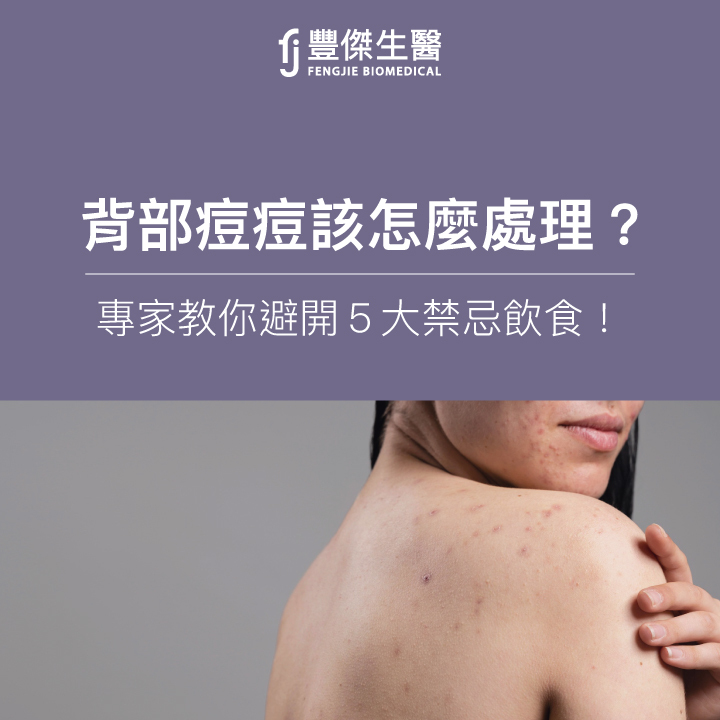背部長痘痘怎麼辦?專家教你6招「預防背部痘痘」+ 5大禁忌飲食!