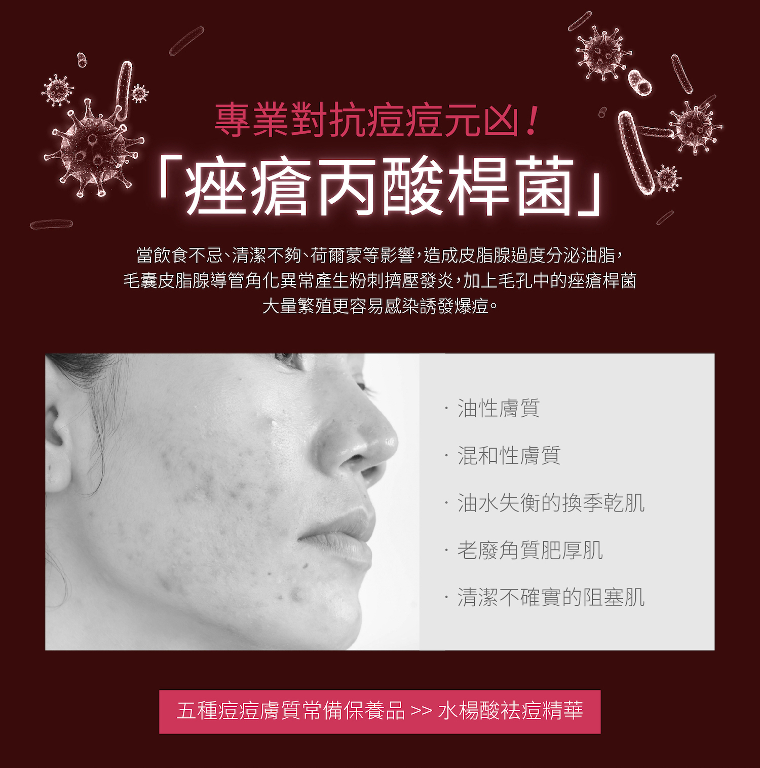 五種痘痘膚質常備保養品 從根源有效打擊痘痘菌群─痤瘡桿菌、預防粉刺爆痘、收斂緊緻毛孔1瓶3效,清爽不悶好吸收!