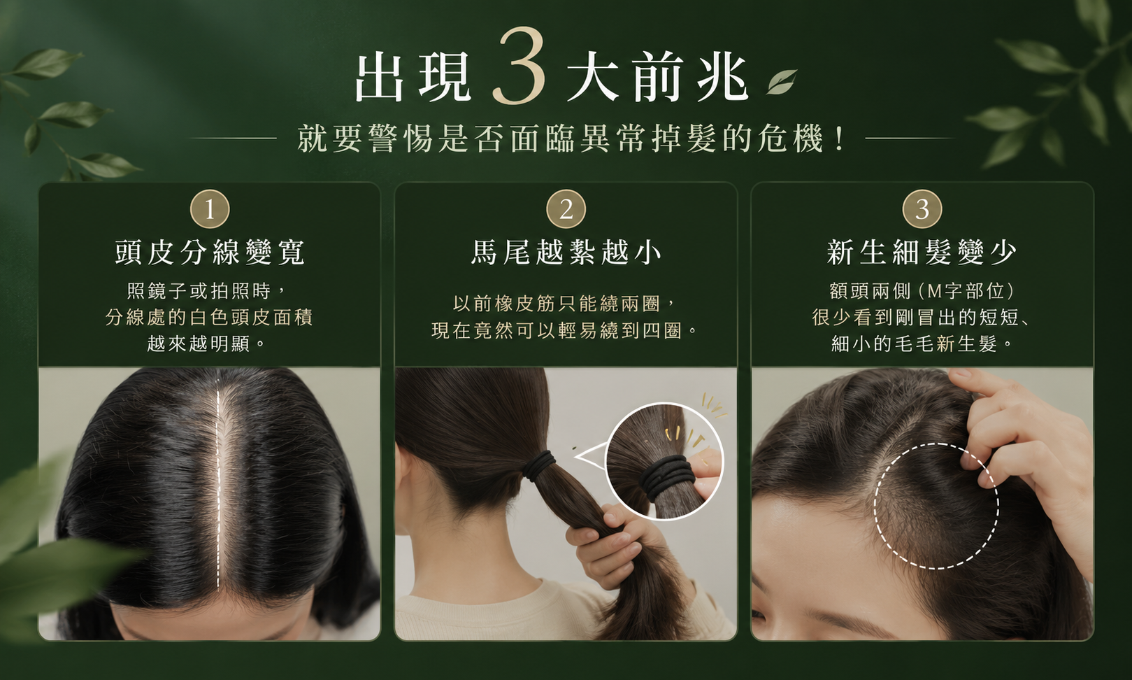 掉髮三大前兆