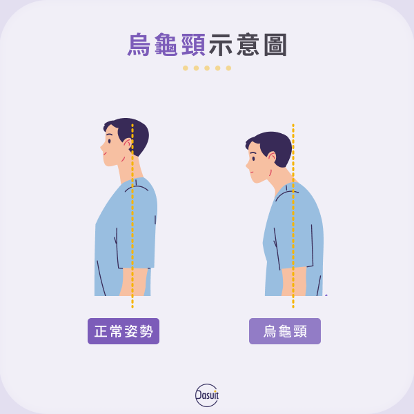烏龜頸示意圖