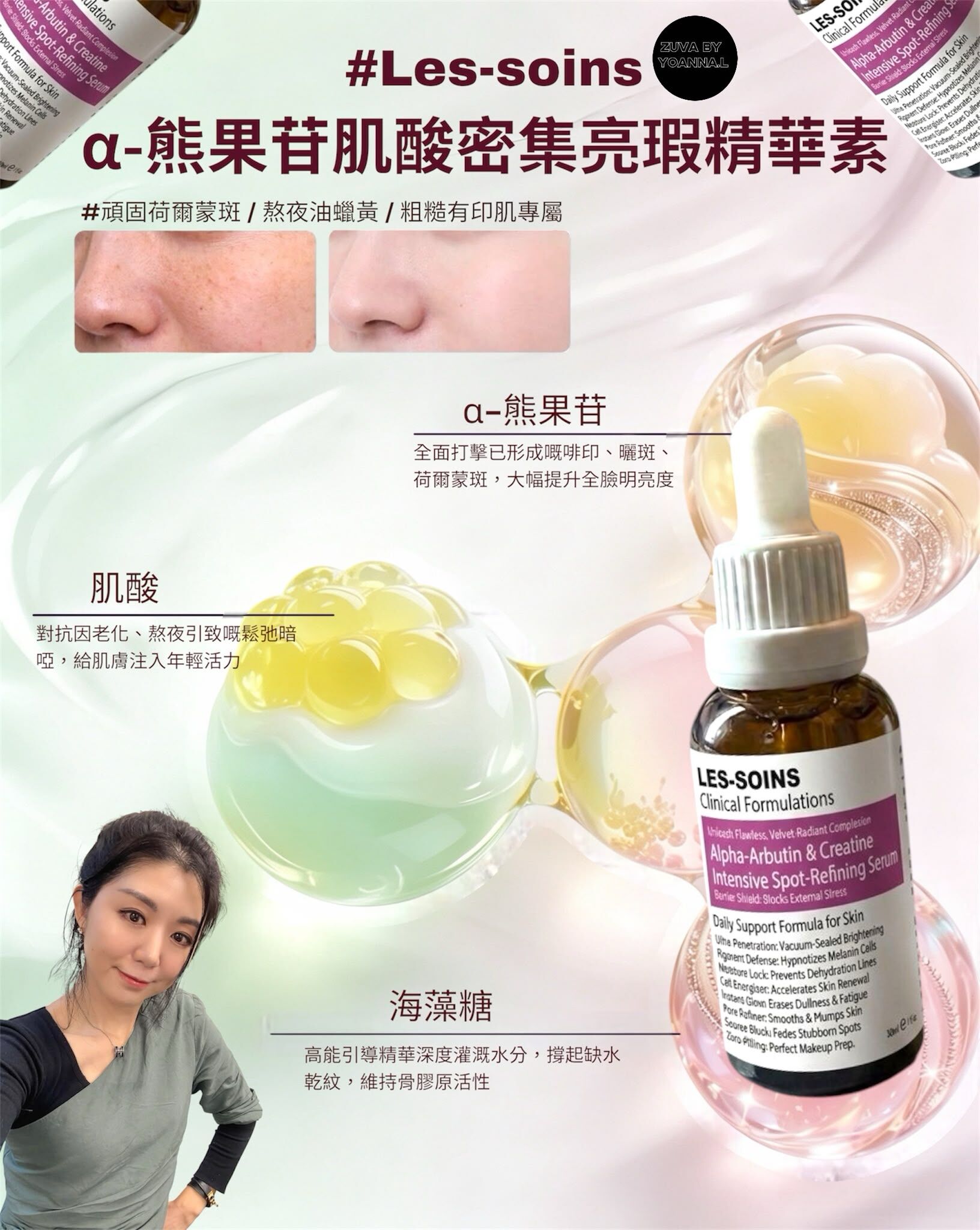 (源頭斷黑極光滴) 💎 Les-Soins  α-熊果苷肌酸密集亮瑕精華素 30ml  T400 🧪✨