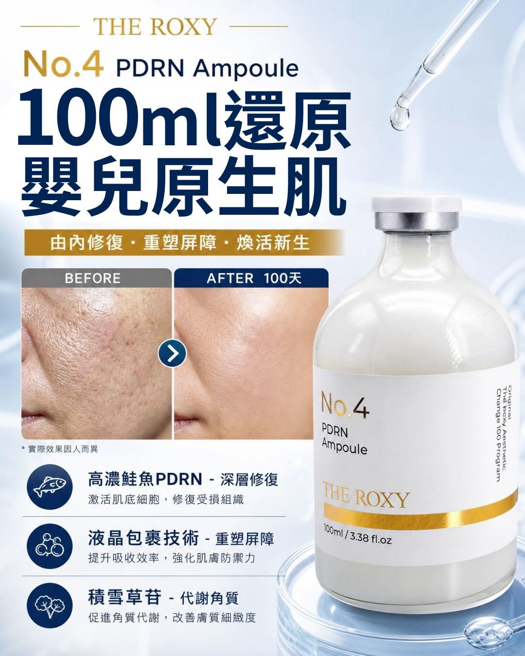 The Roxy No.04 PDRN Ampoule 100ml