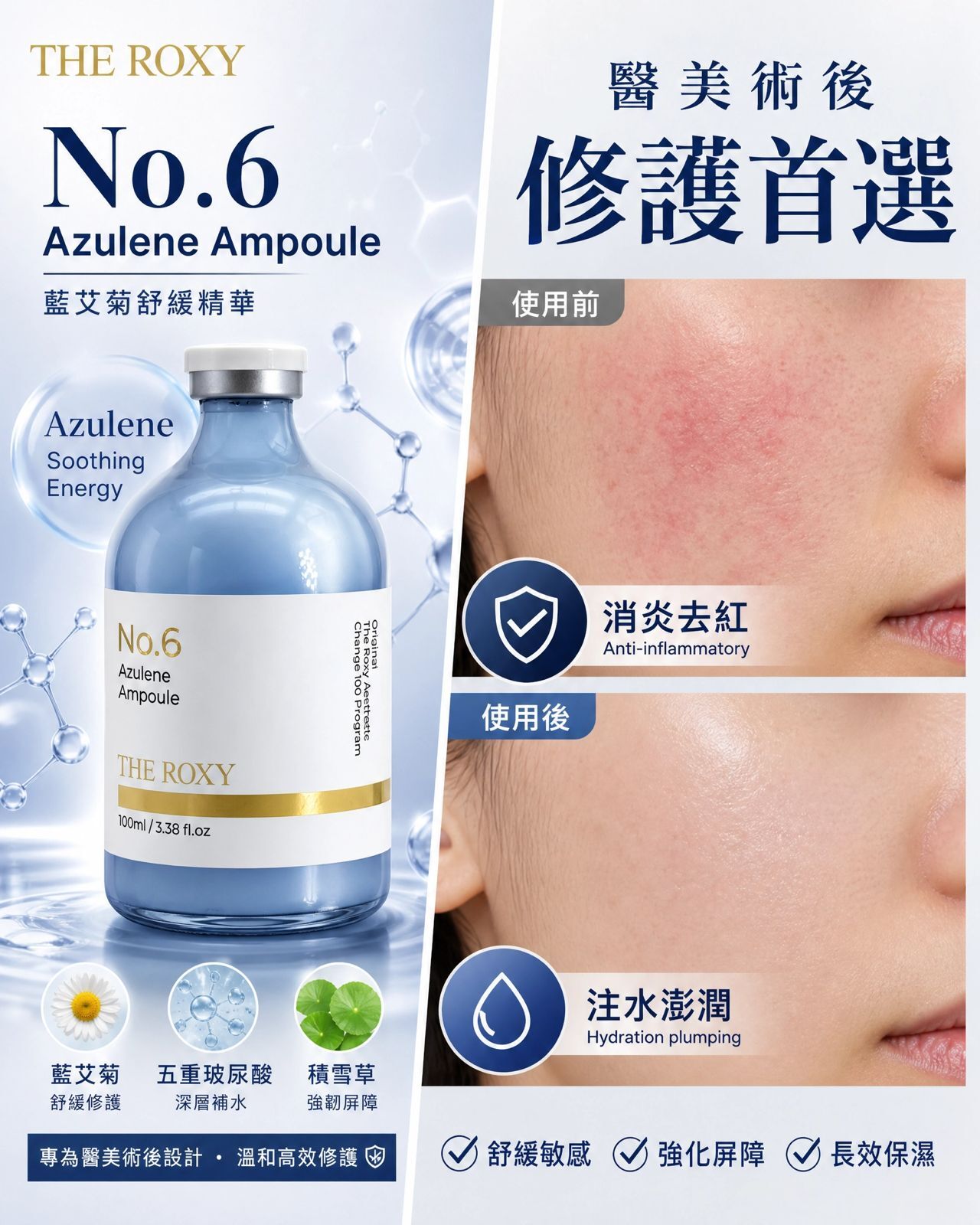 The Roxy No.06 Azulene Ampoule 100ml
