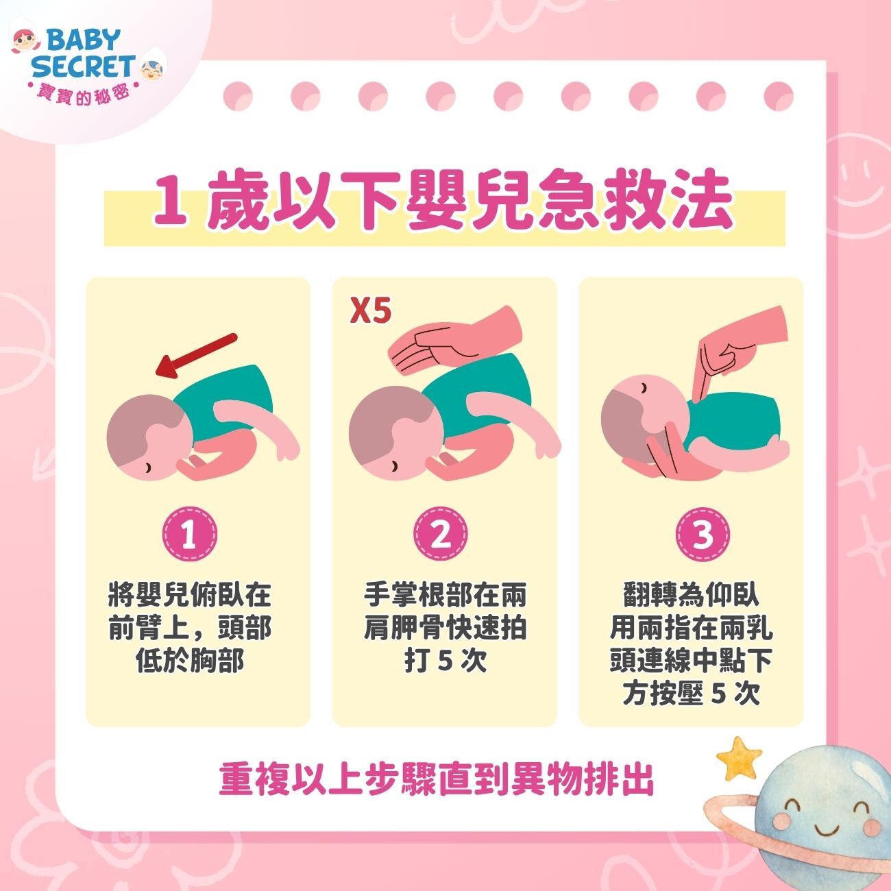 1 歲以下嬰兒：拍背壓胸法
