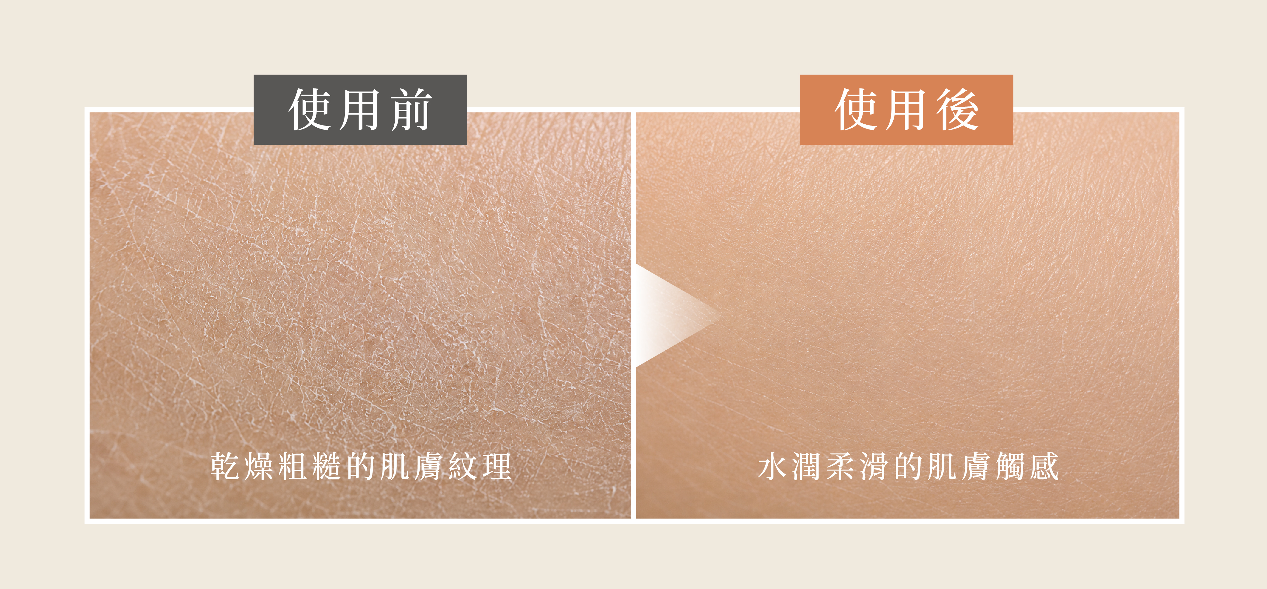 She is後生元私密淨毛膏添加LAB35後生元，維持角質健康