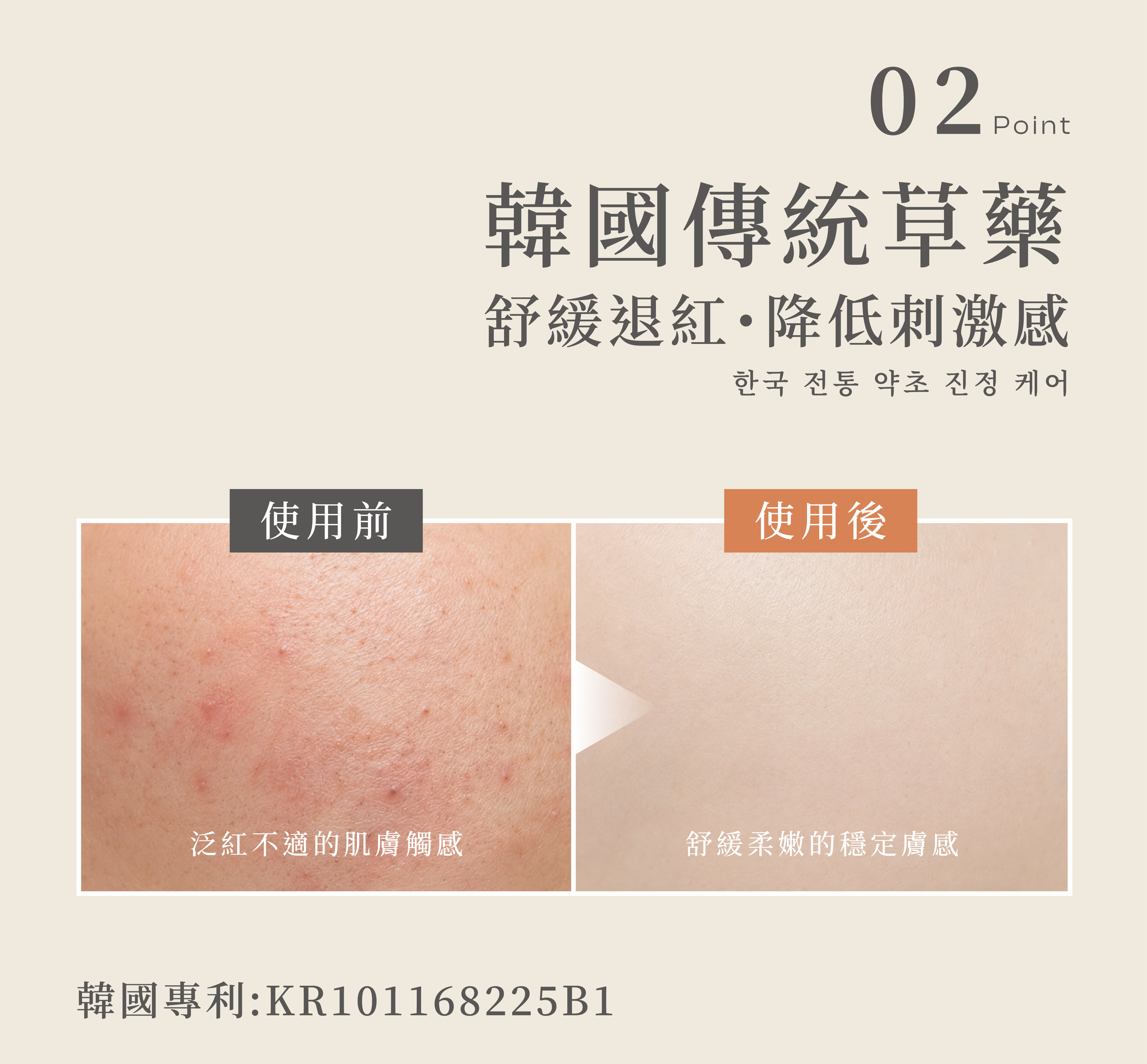 She is後生元私密淨毛膏添加專利韓國藥草，舒緩退紅，降低刺激