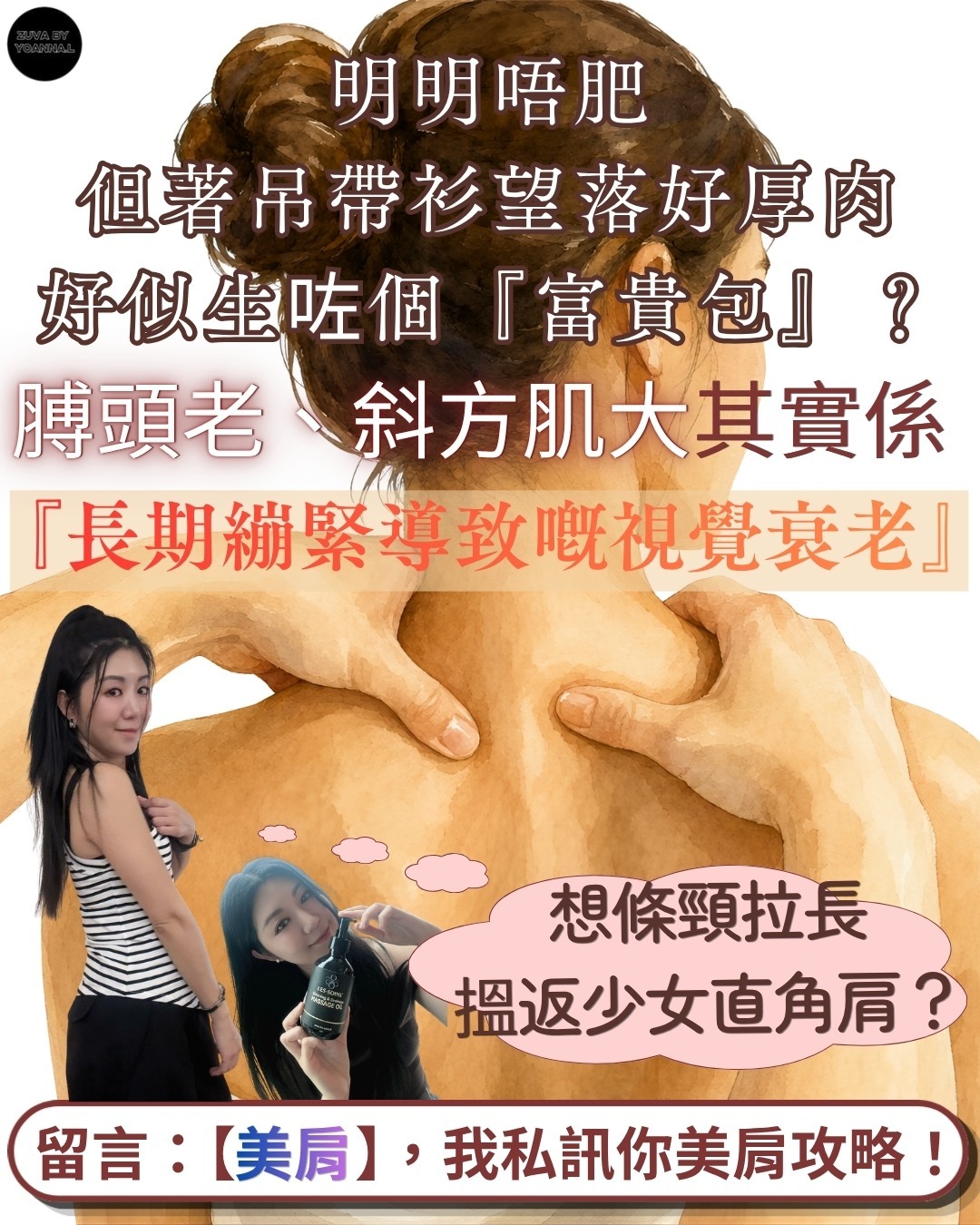 大媽膊（斜方肌肥大 / 虎背熊腰）