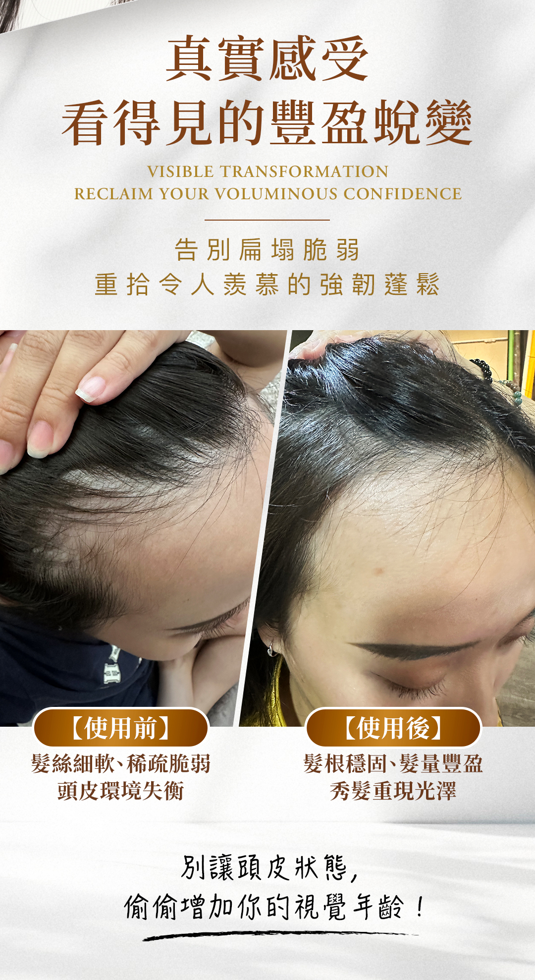 SASANA 養髮噴霧精華使用前後對比圖，真實呈現從髮絲細軟稀疏、頭皮環境失衡，蛻變為髮根穩固、髮量豐盈且充滿光澤的強韌視覺效果。