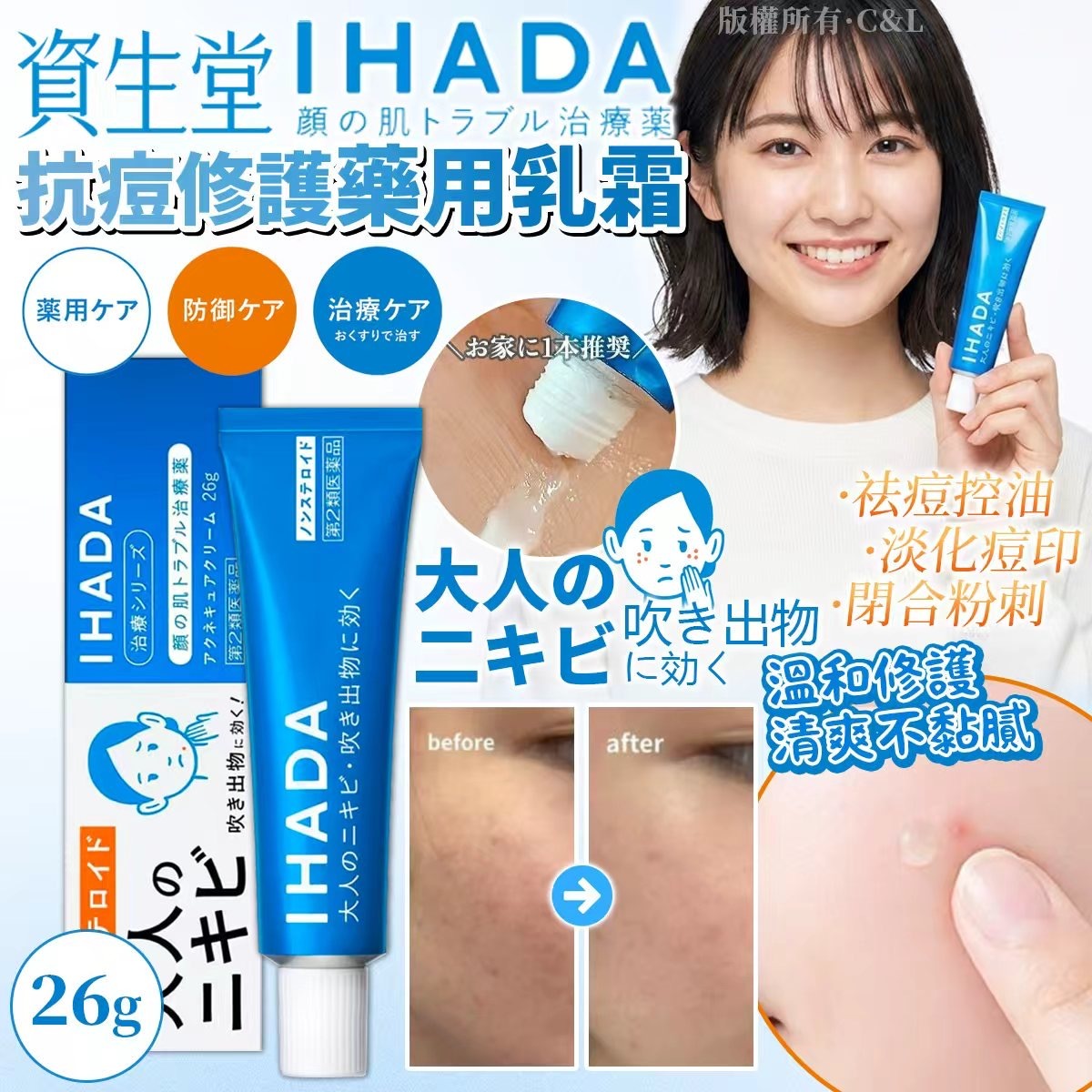 資生堂IHADA祛痘霜26G