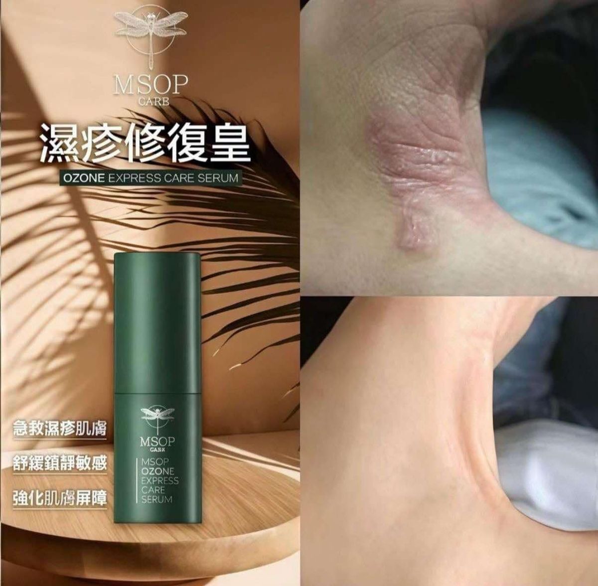 韓國MSOP 逆時修復霜30ML 濕疹救星