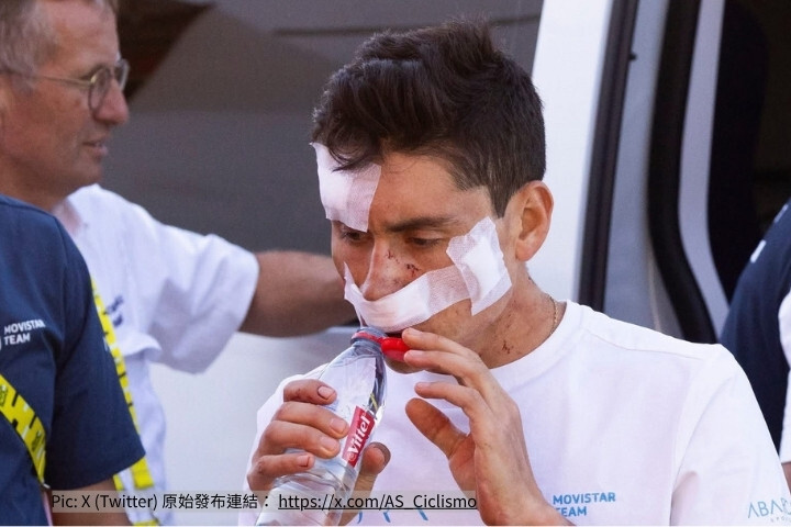 Movistar 車手 Einer Rubio 於環法 Stage 19 追撞隊車後臉部重創包紮的現場照片