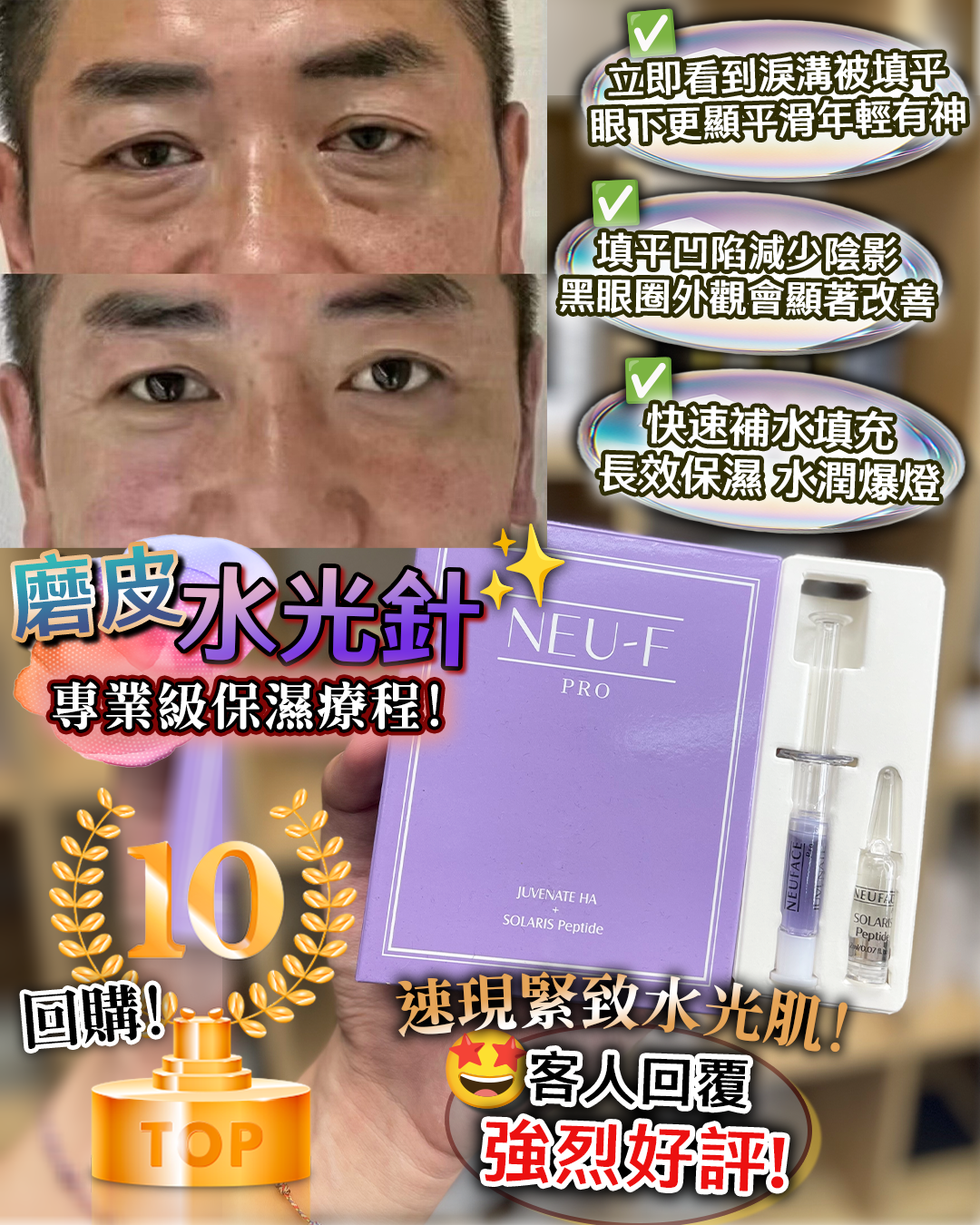 Neu-F Pro Juvenate Ha 2盒