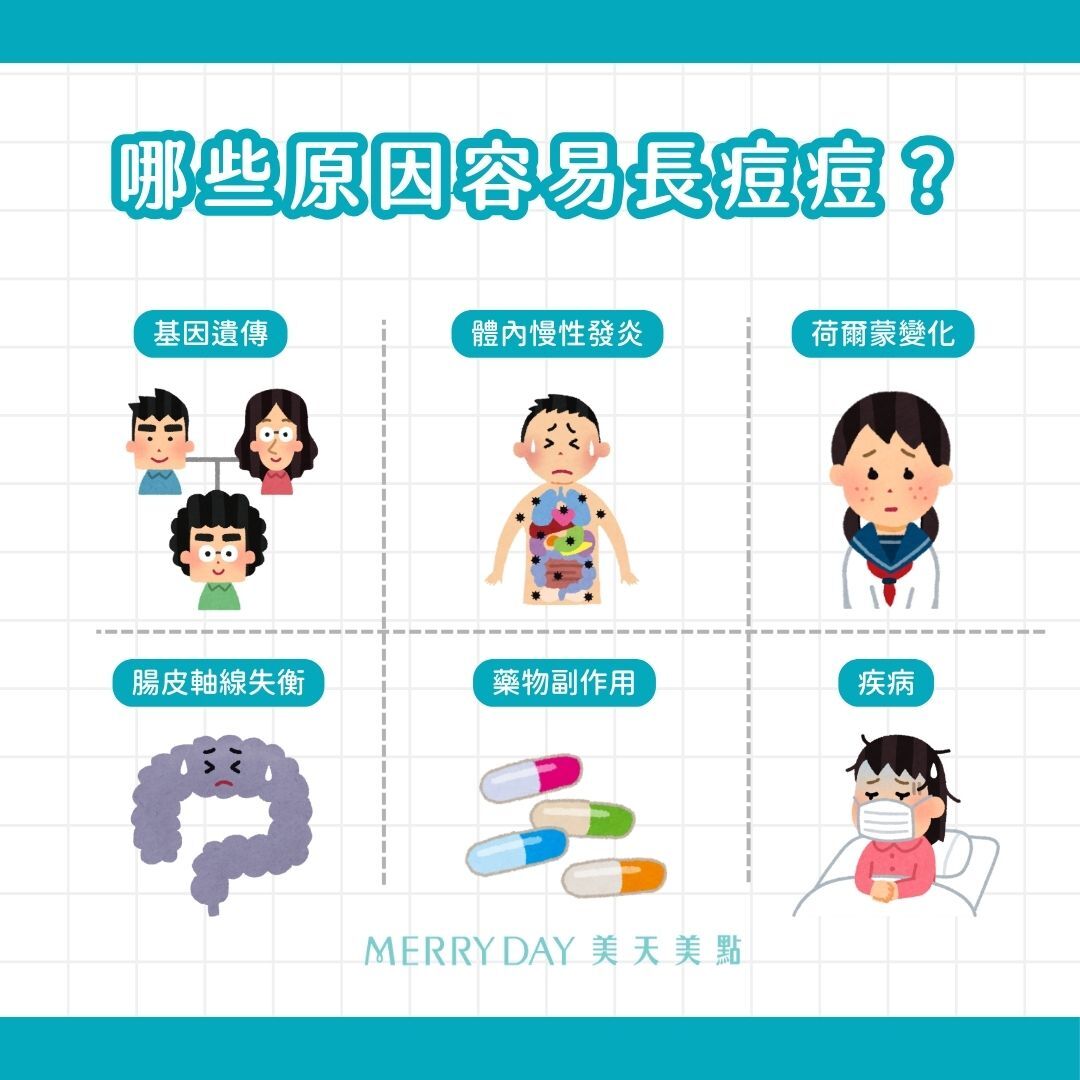 哪些原因會讓你容易長痘痘?基因遺傳、體內慢性發炎、荷爾蒙變化、腸皮軸線失衡、藥物副作用、疾病
