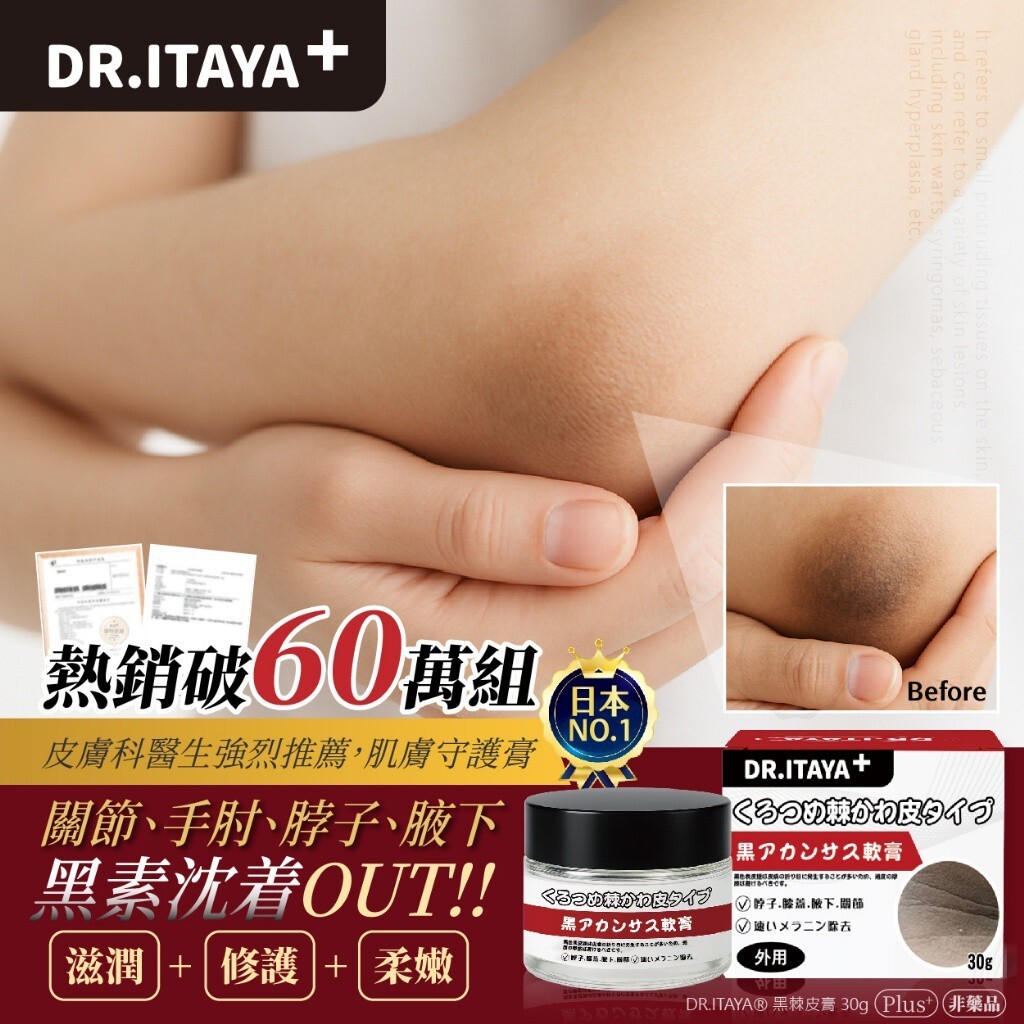 WSBB12421  DR.ITAYA® 黑棘皮膏 30g（9月下旬）