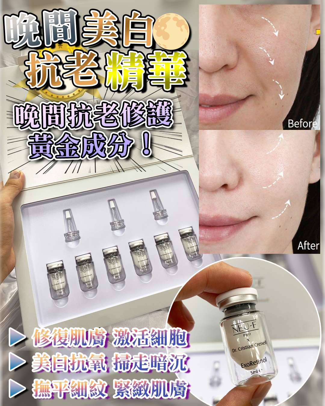 2026 Happy Summer Sale_ Neu-F Pro Exo Rentinol 晚間美白抗老精華（白色）5ml x6（貨期截單後一個月）