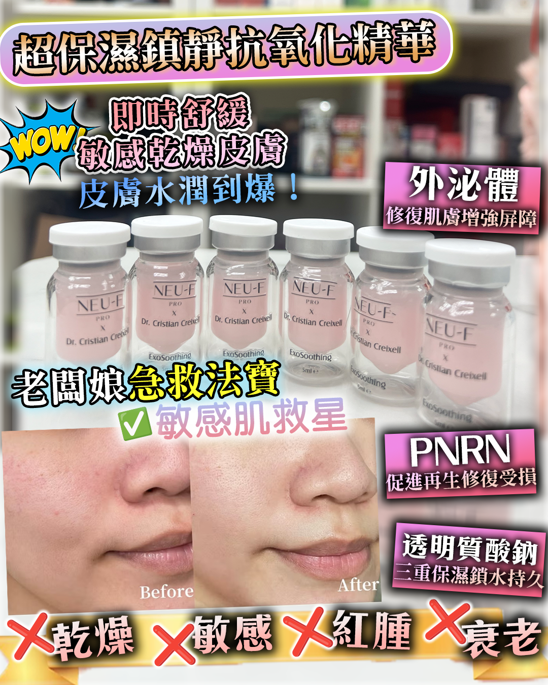 2026 Happy Summer Sale_ Neu-F Pro Neu-F ProExo Soothing + PDRN （貨期截單後一個月）