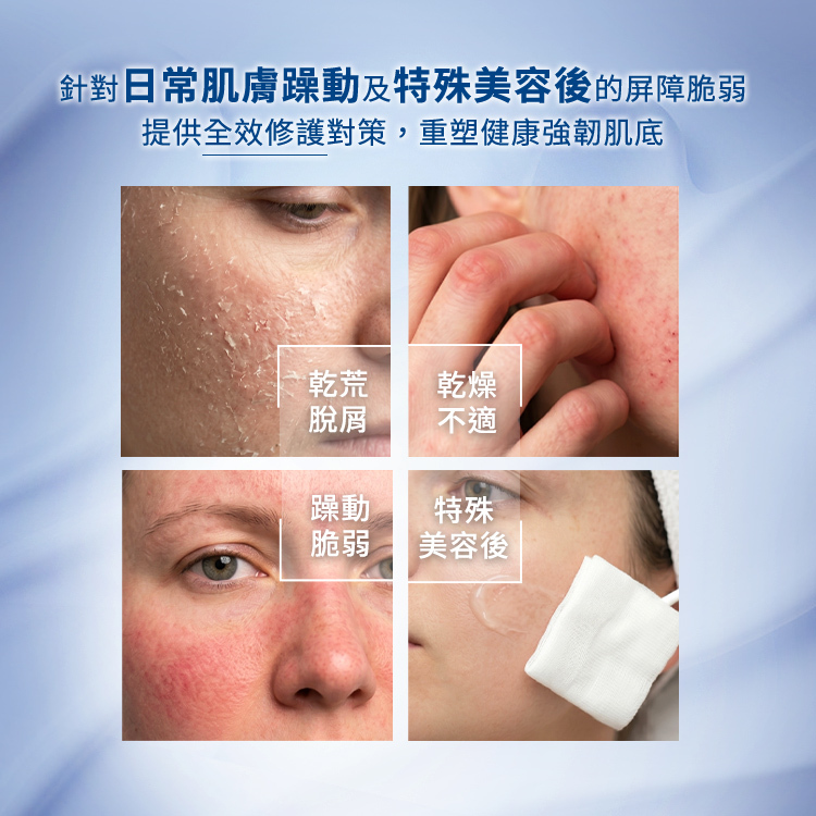 日常肌膚躁動與特殊美容後的屏障修護對策