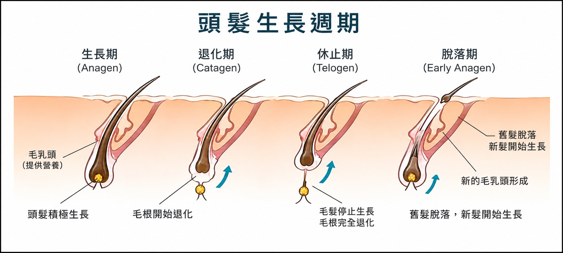 本蘊,頭髮生長週期,頭髮,落髮,掉髮,掉頭髮,產後掉髮,產後落髮,本蘊有效嗎,植髮,禿頭,髮際線,頭髮很容易掉,髮絲,頭髮保健食品,毛囊,休止期,護髮,養髮,髮量,頭皮,雄性禿,細軟髮