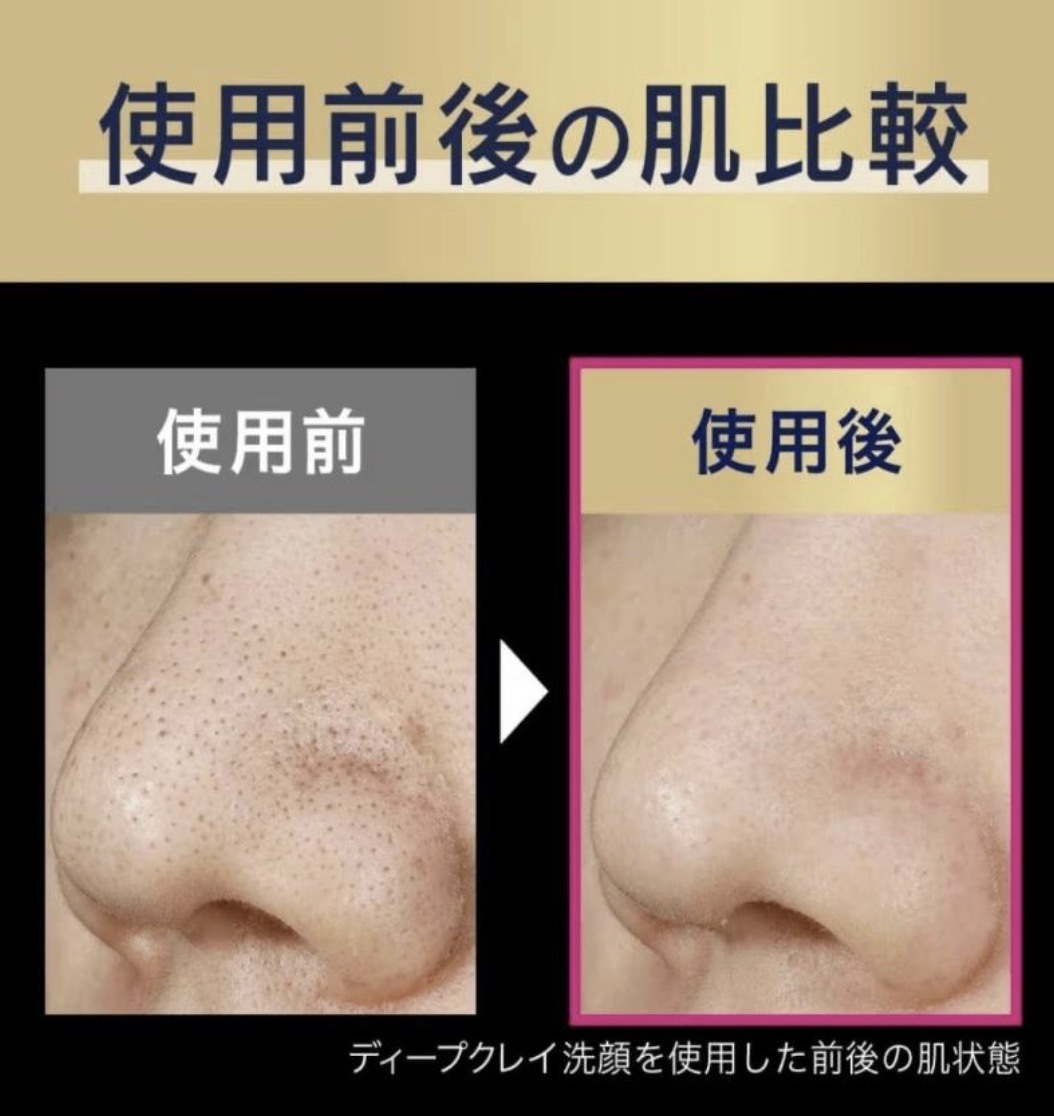 【超級難搵】JP 角栓崩壊 x 美容院級 Biore 深層毛孔黑炭泥洗面乳 180g 4057 TK260803