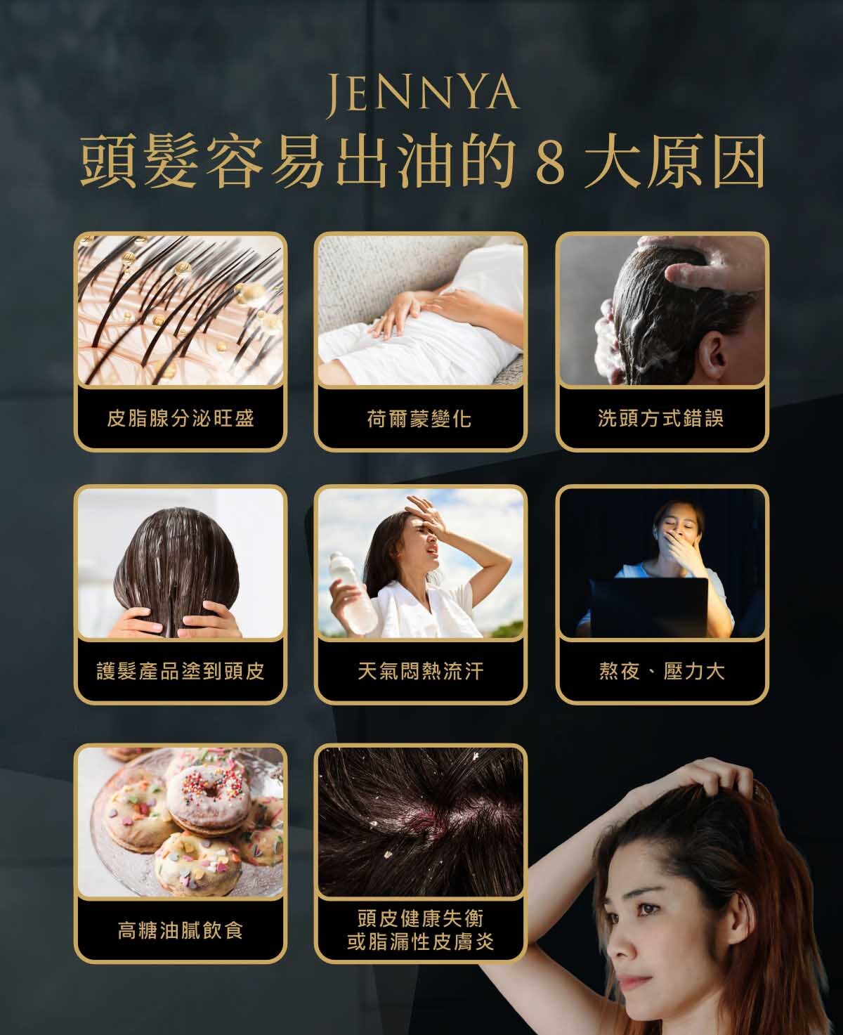 頭髮容易出油原因整理圖，說明頭髮容易出油的 8 大原因，包括皮脂腺分泌旺盛、荷爾蒙變化、洗頭方式錯誤、護髮產品塗到頭皮、天氣悶熱流汗、熬夜壓力大、高糖油膩飲食，以及頭皮健康失衡或脂漏性皮膚炎。
