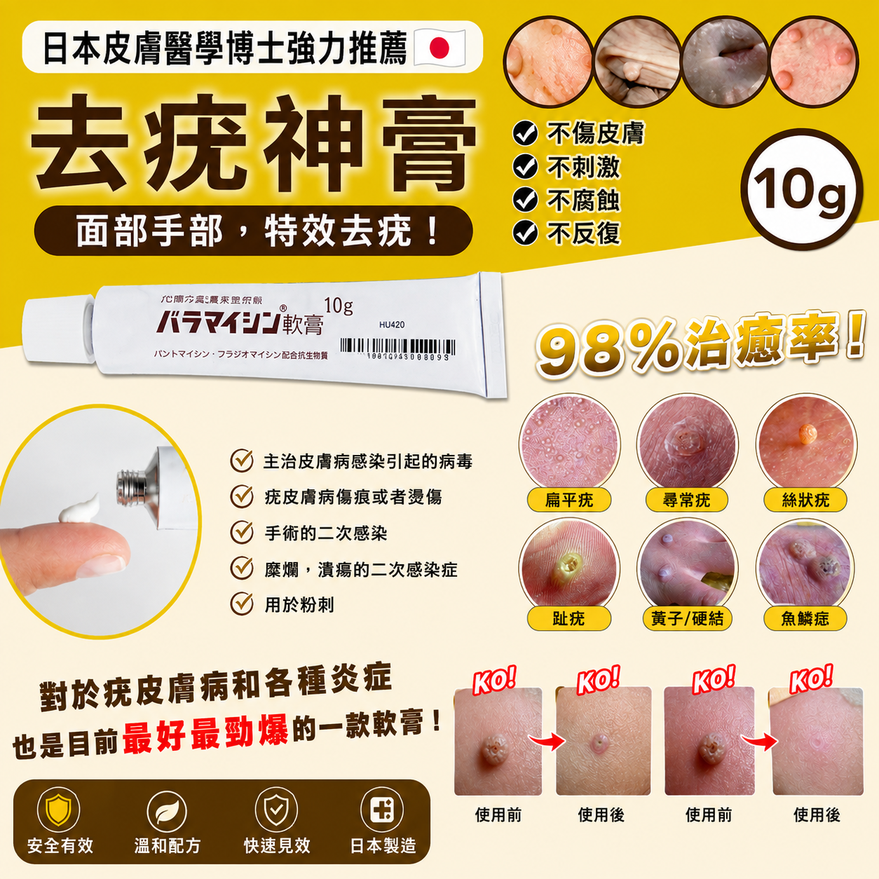 【UB9992】日本本土版扁平疣膏 10g