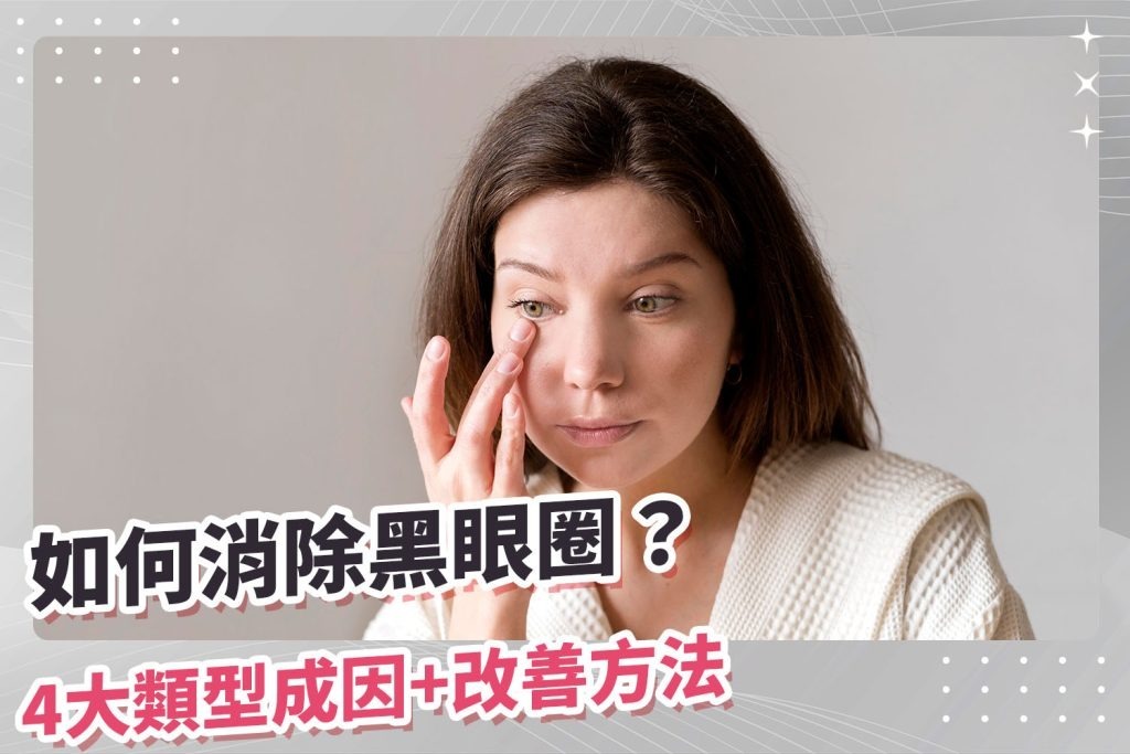 如何消除黑眼圈