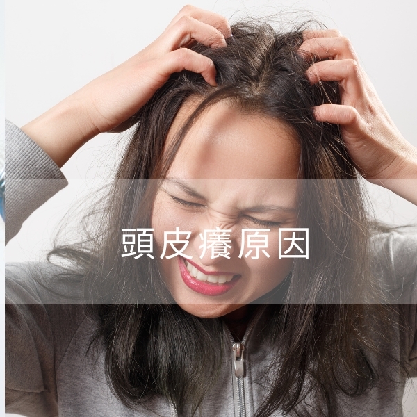 頭皮癢、頭皮屑變多怎麼辦？揭密8大頭皮癢原因+6招舒緩解方