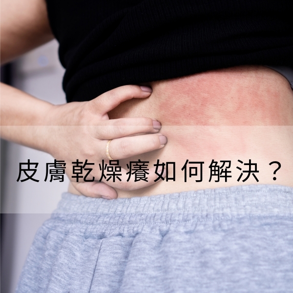 皮膚乾燥癢如何解決？解析皮膚乾裂、乾癢脫皮原因與5大照護方法
