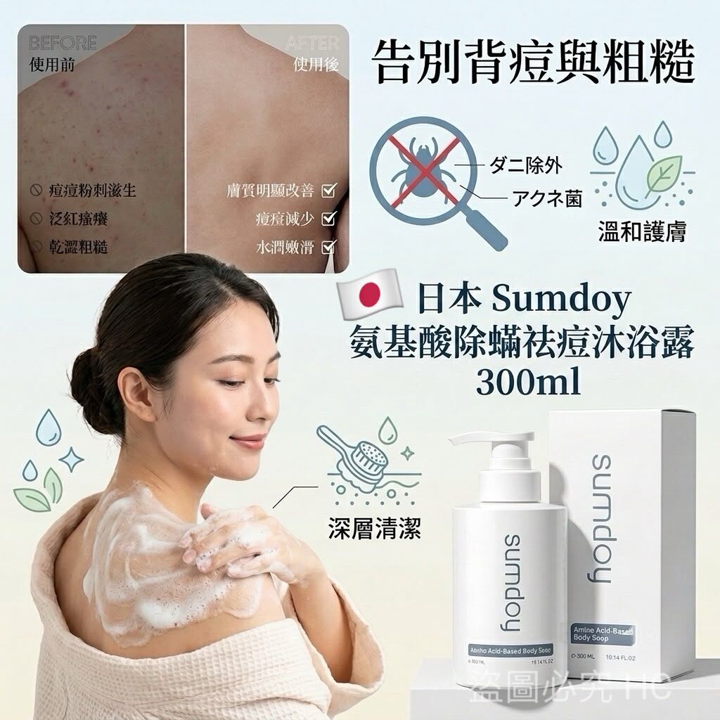 S22462日本 Sumdoy 氨基酸除蟎祛痘沐浴露 300ml
