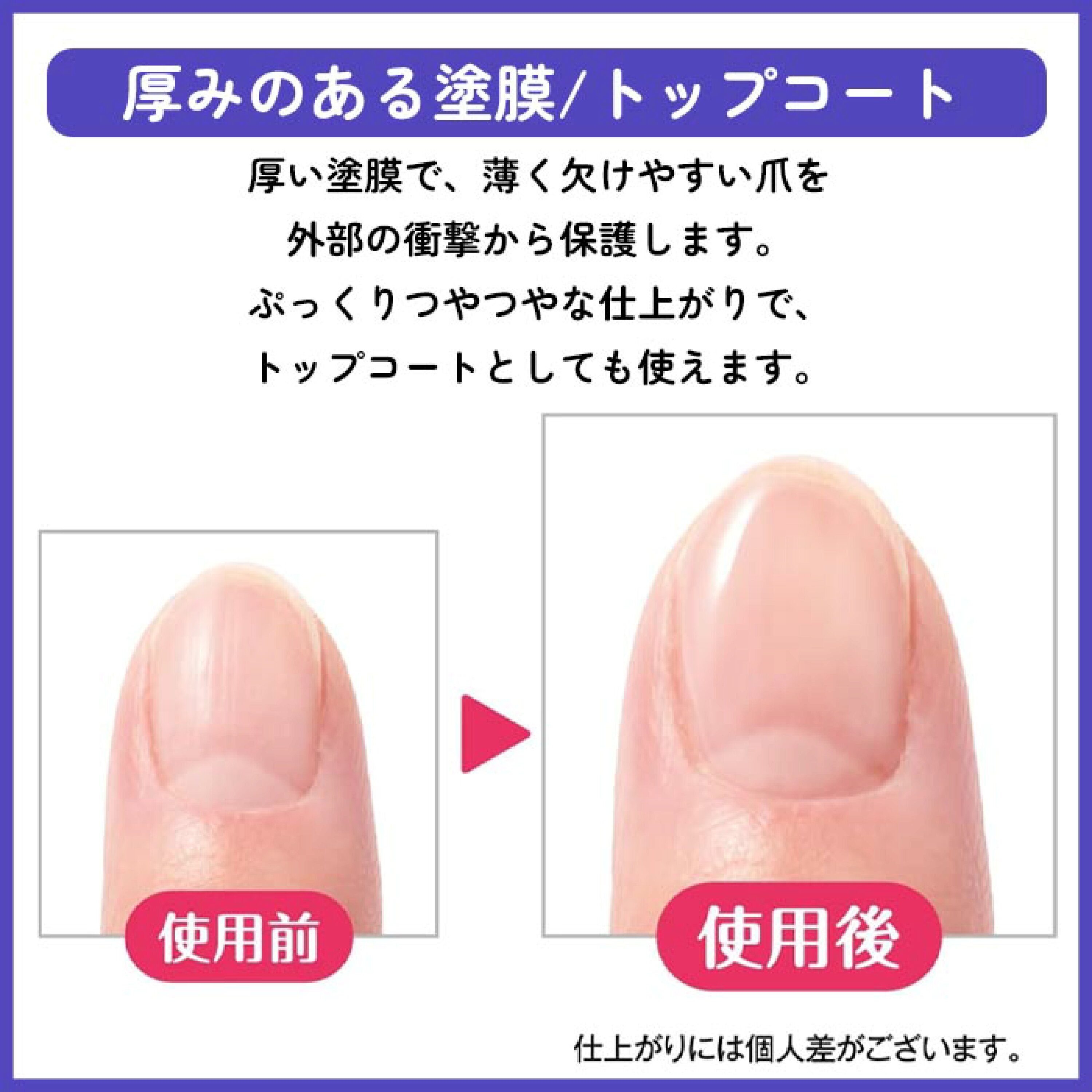 JP 日本製 KOJI Nailist 纖維強化指甲油 8306 TK260811
