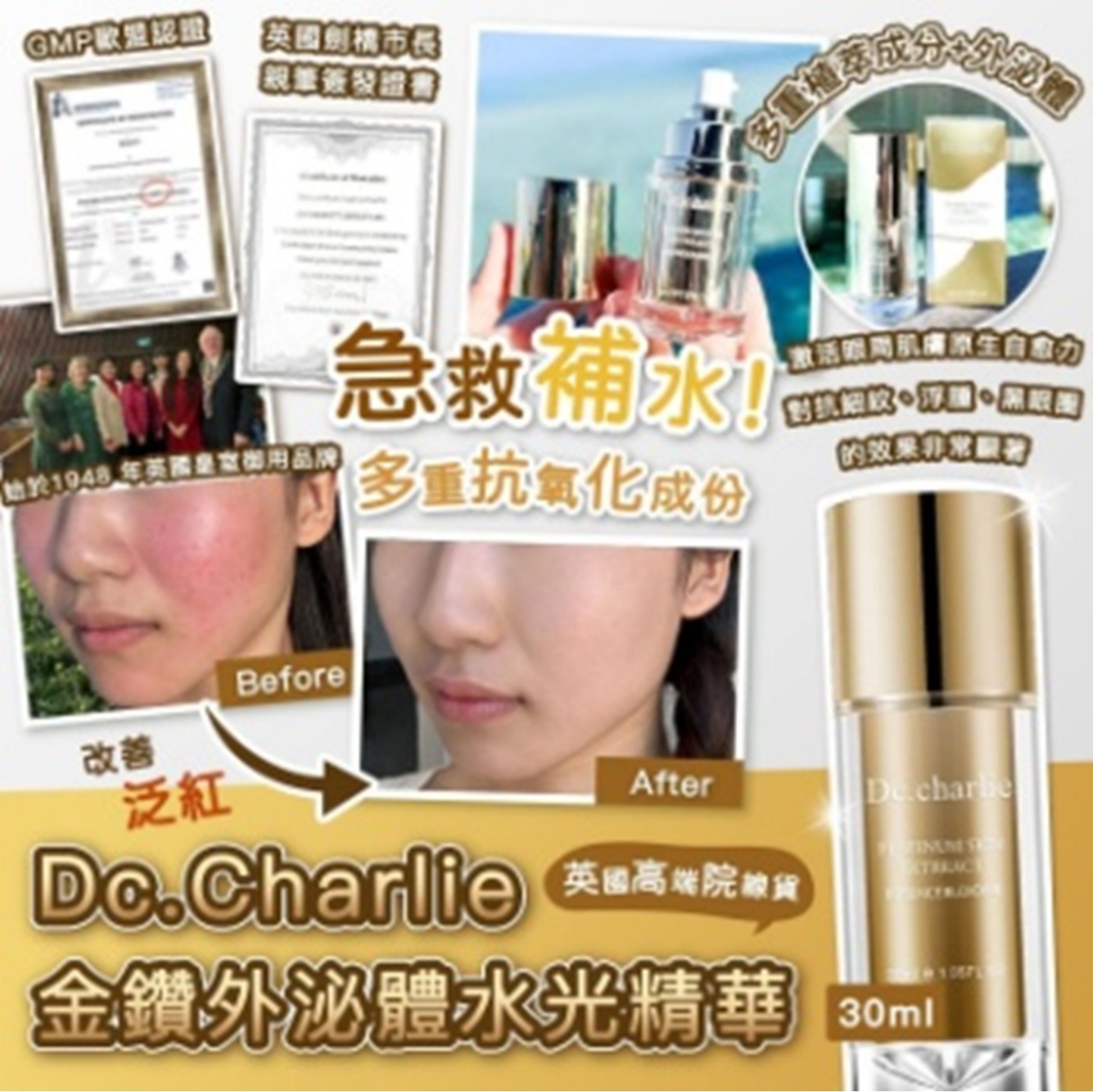 (H) 升級版鉑金高效修護、抗老精華液(30ml) (任選綠色/金色系列 3件或以上$168/件) (買5件隋機送綠色/金色系列1件) - 金色系列 - 英國Dc Charlie #2708DR
