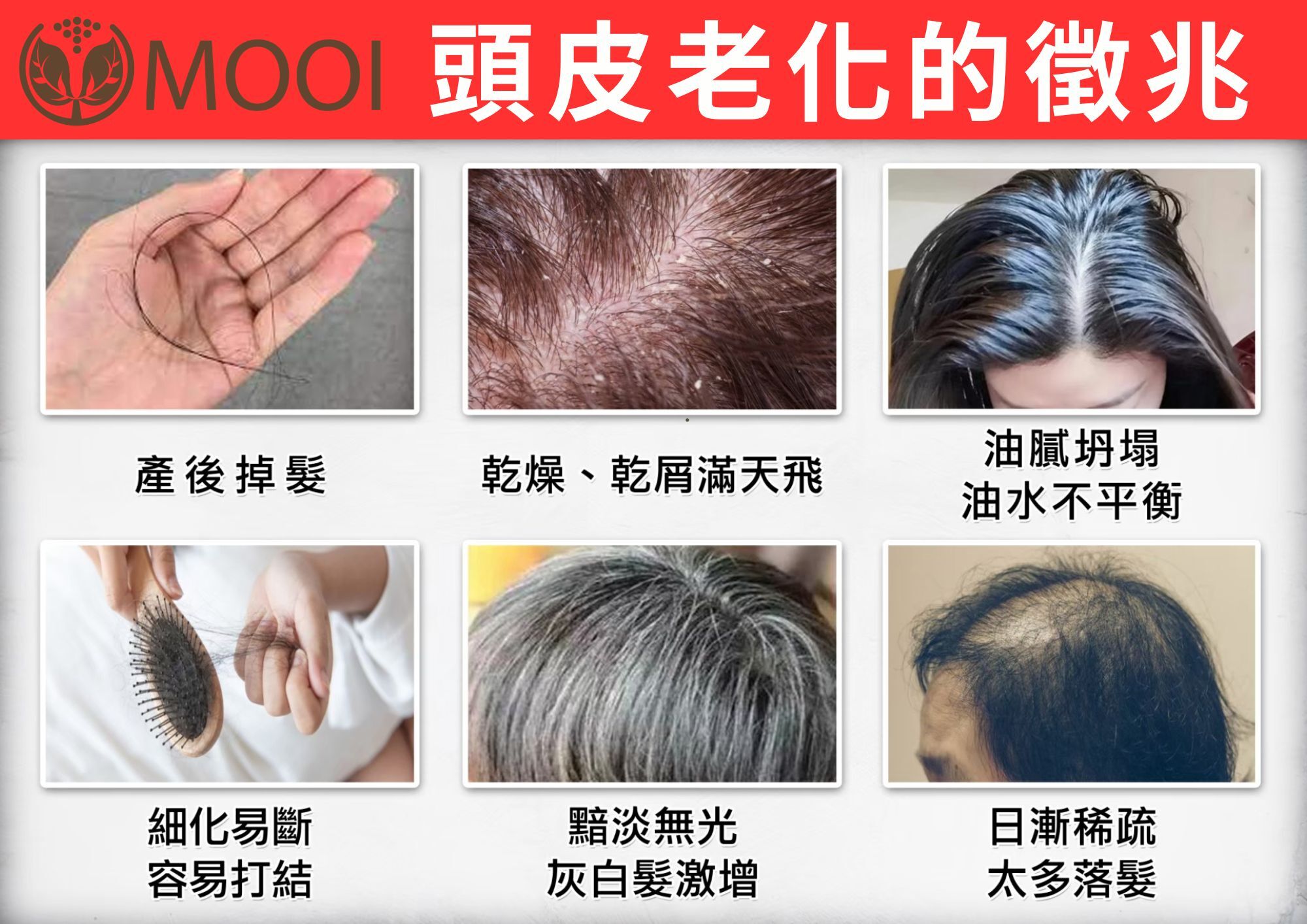 DL006 MOOI 密髮森養髮液 30ML***孕婦都可用的生髮喚黑***