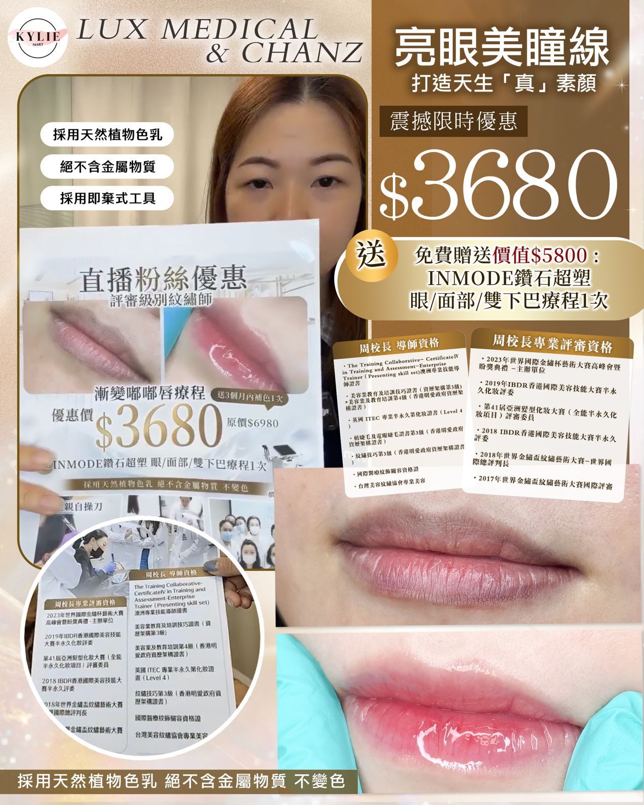 Lux Medical 漸變嘟嘟唇療程