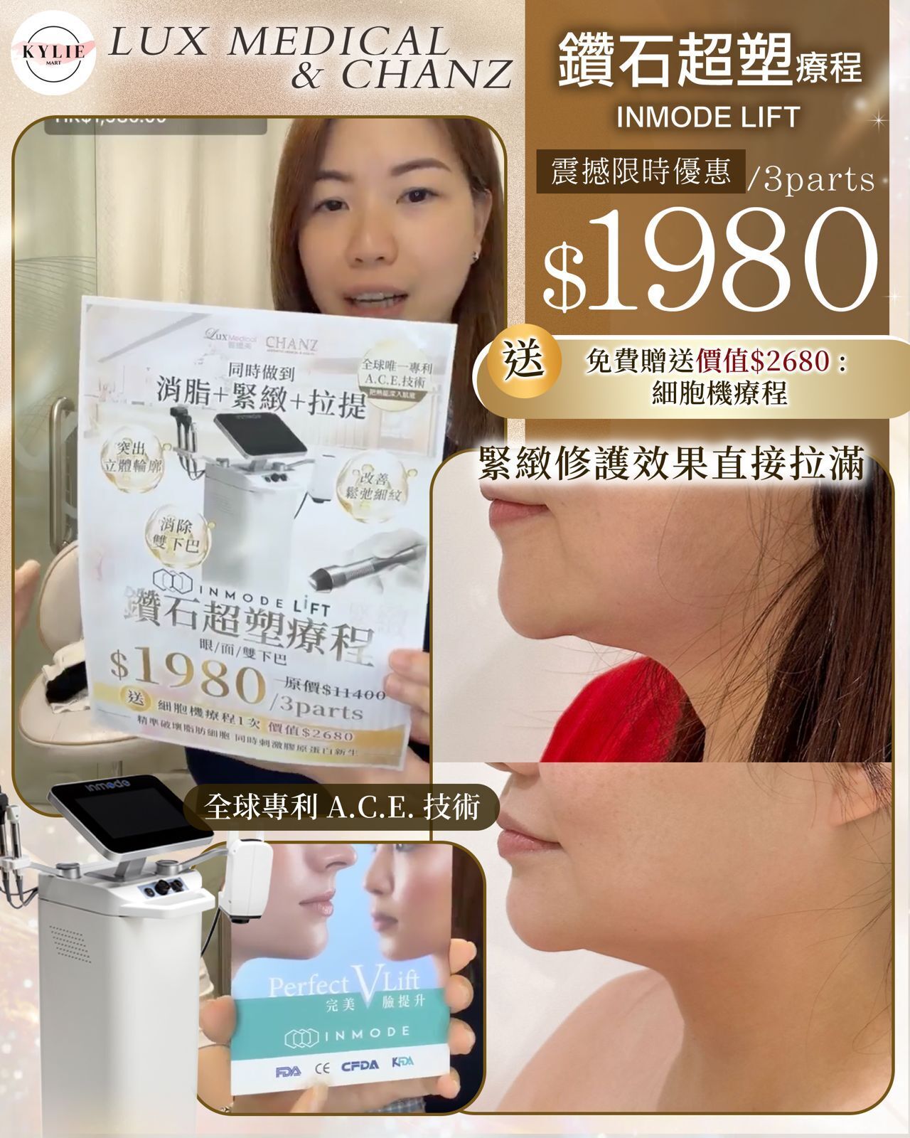 Lux Medical INMODE LIFT 鑽石超塑療程