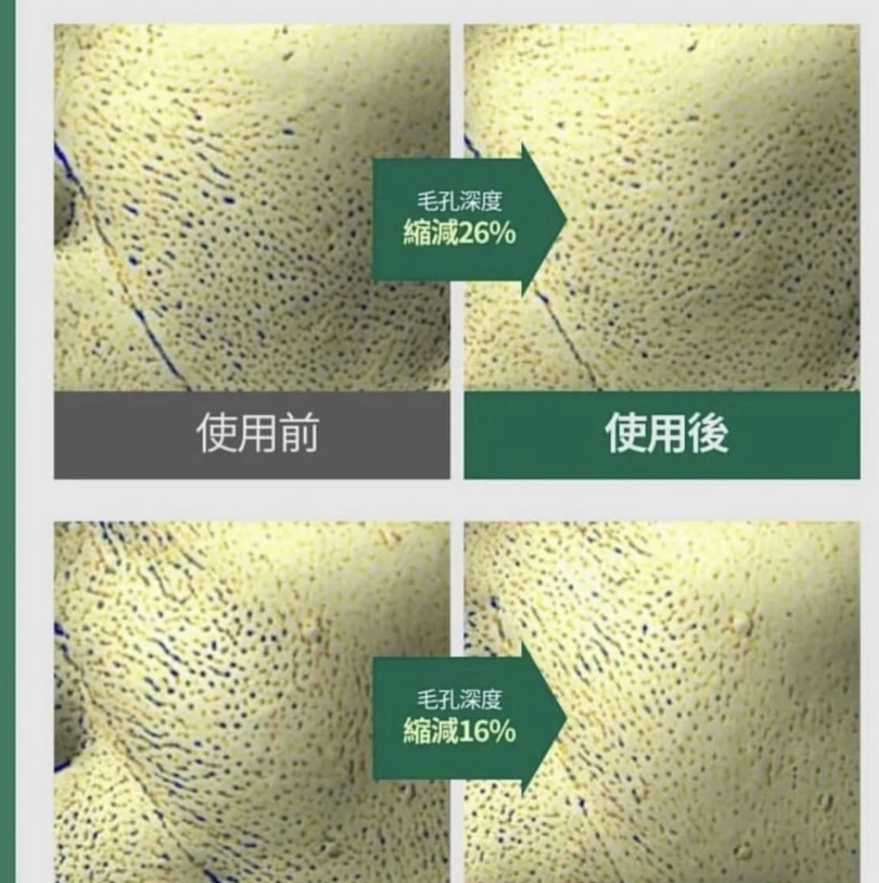 【預購】Sungboon Editor WKR081411 綠蕃茄毛孔緊緻安瓶精華 75ml (買一送一)（送隨機軟膜+ 手膜/腳膜一片）