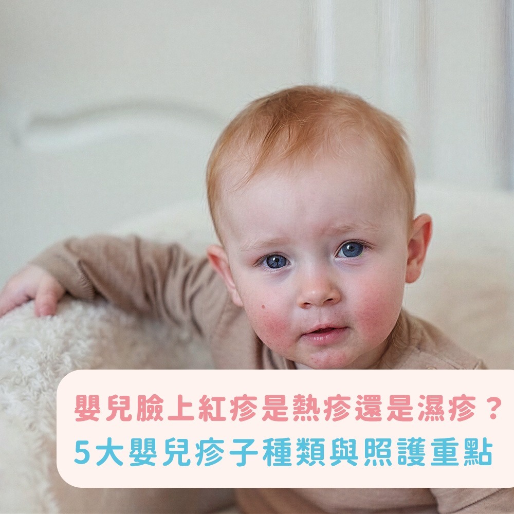 嬰兒臉上紅疹